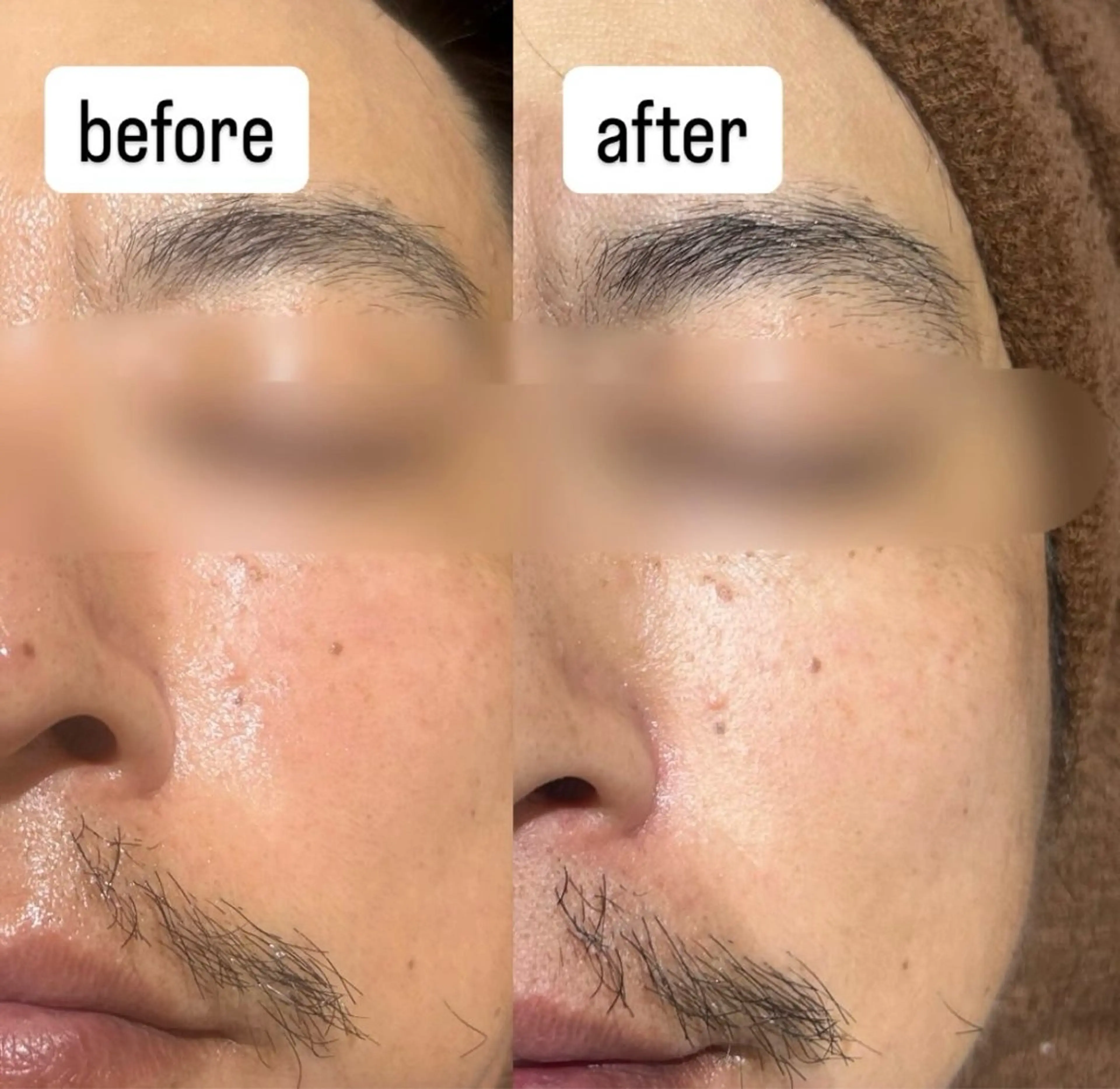 大人気ララピールの写真