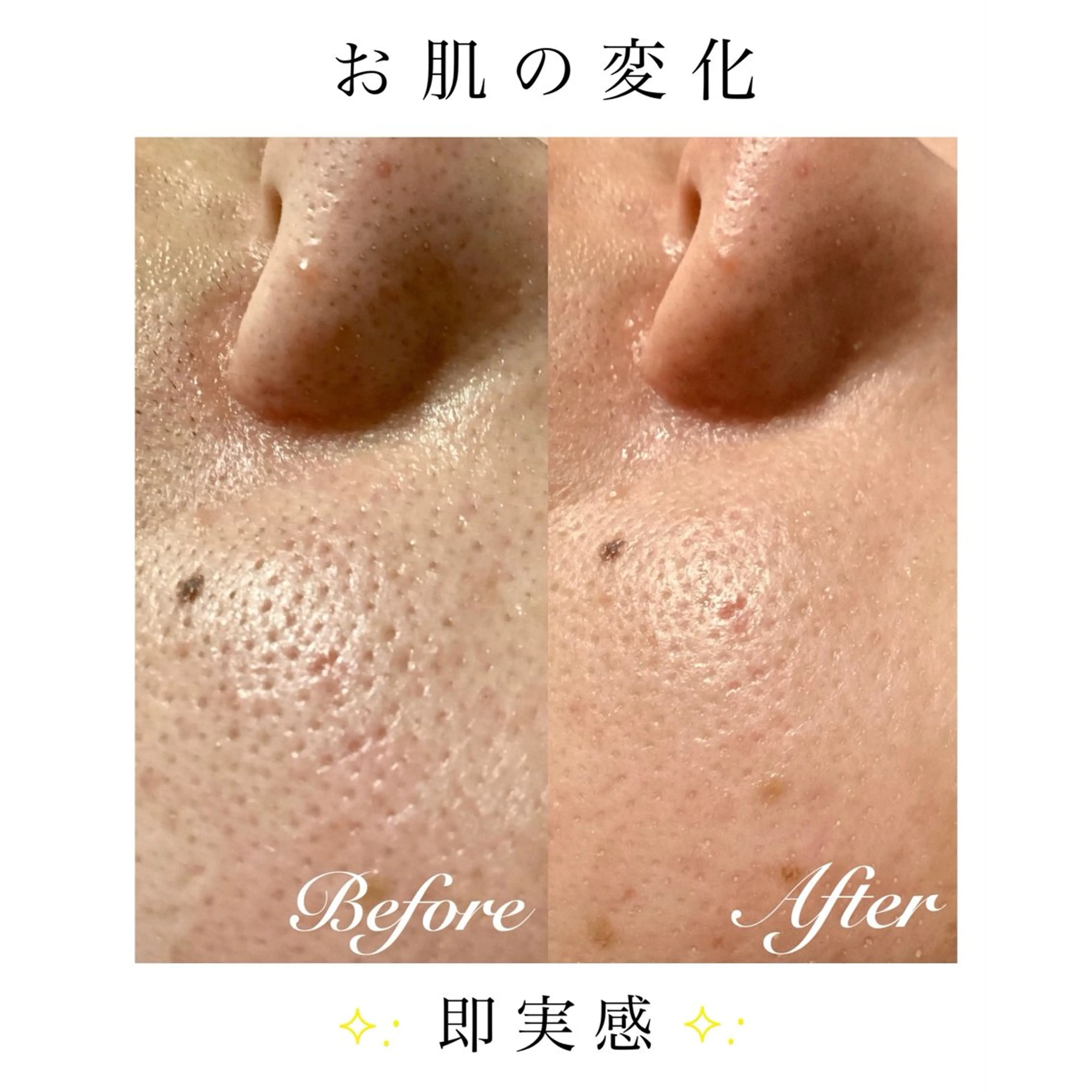 エステ リラク ダイエット・美肌ケア fleurのエステ・リラクイメージ