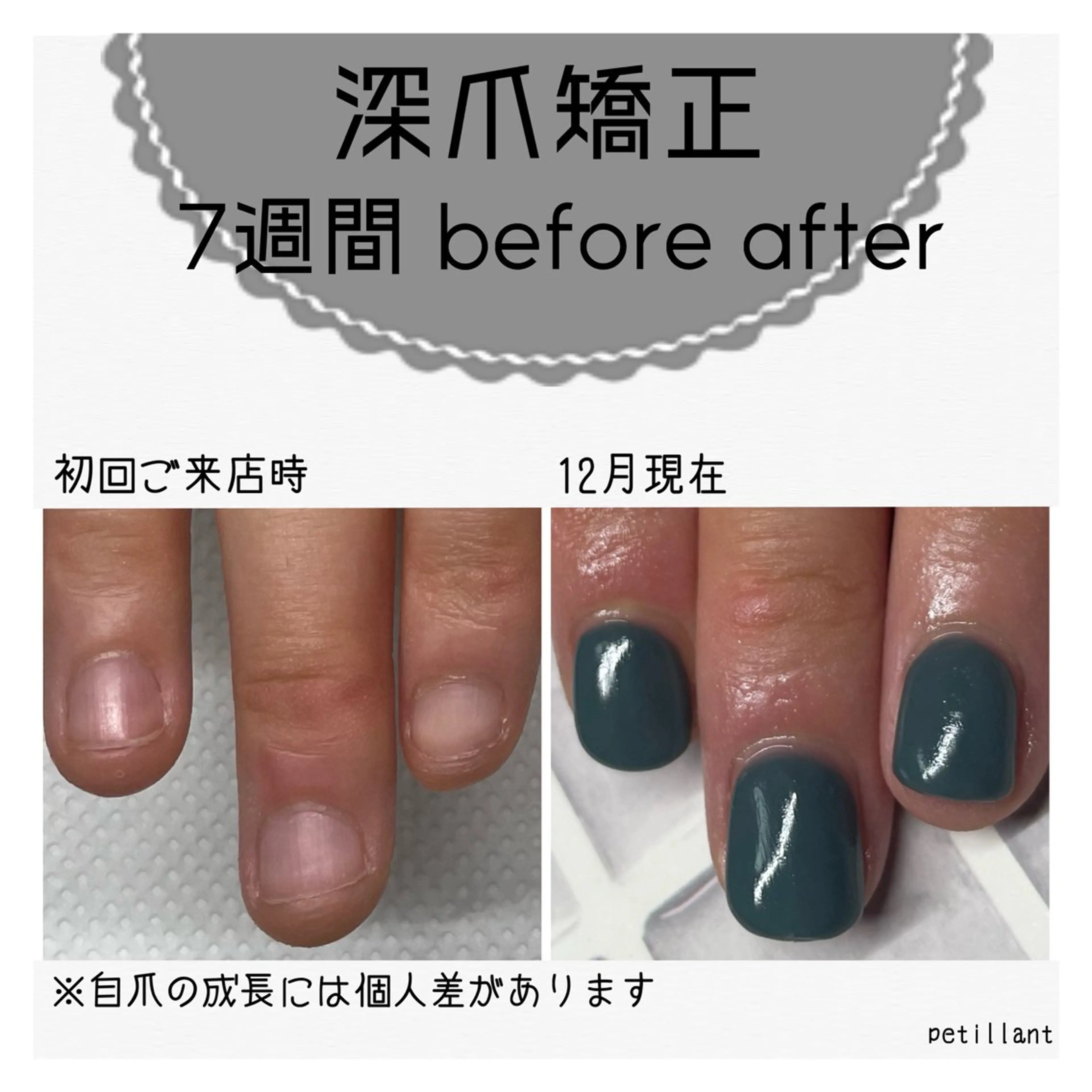 ネイル アートネイル 長さ出し ジェルネイル nail salon petillantのネイルデザイン