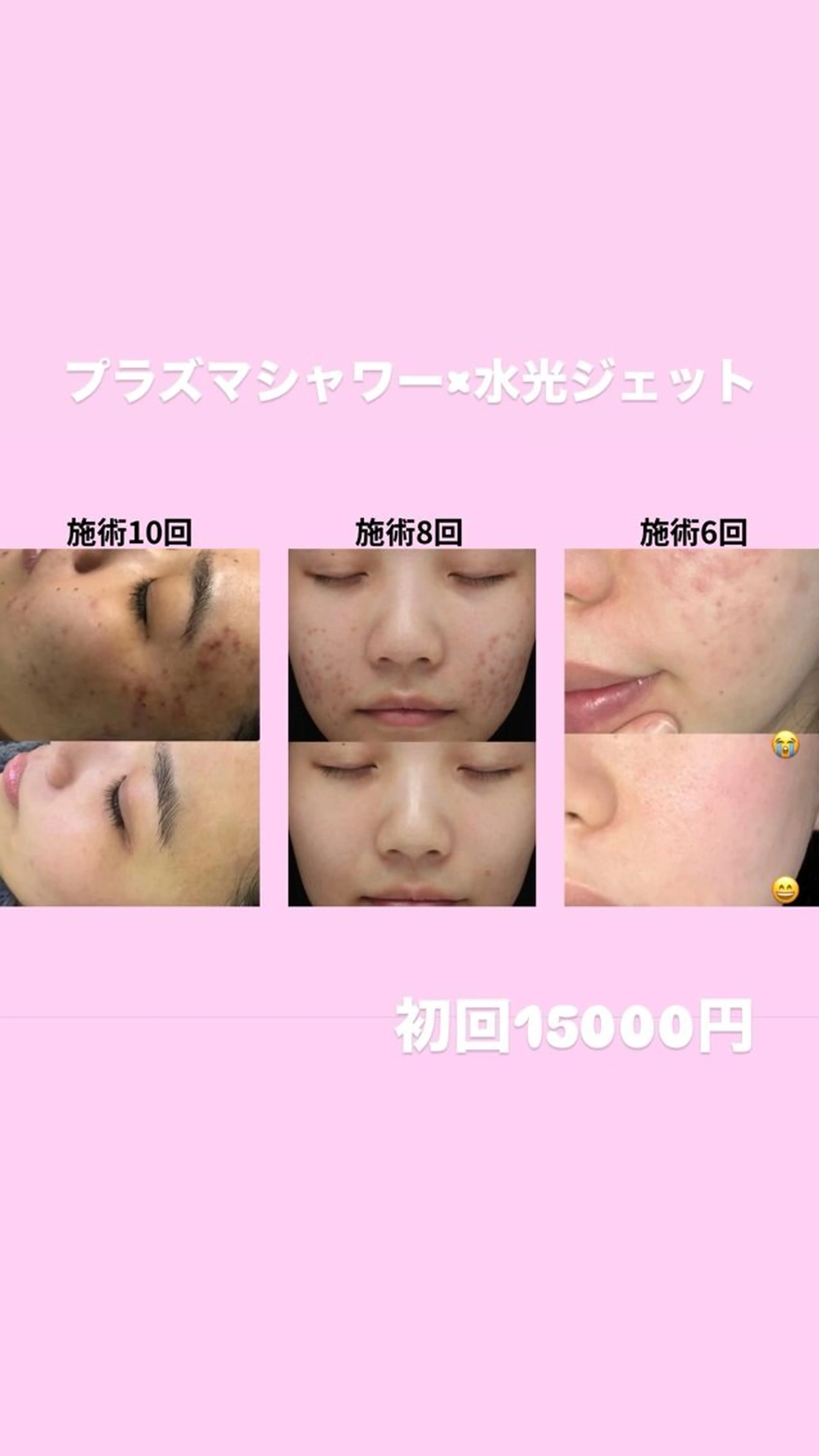 ミディアム エステ リラク 愛維美水光美肌専門店 メンズレディースokのエステ・リラクイメージ