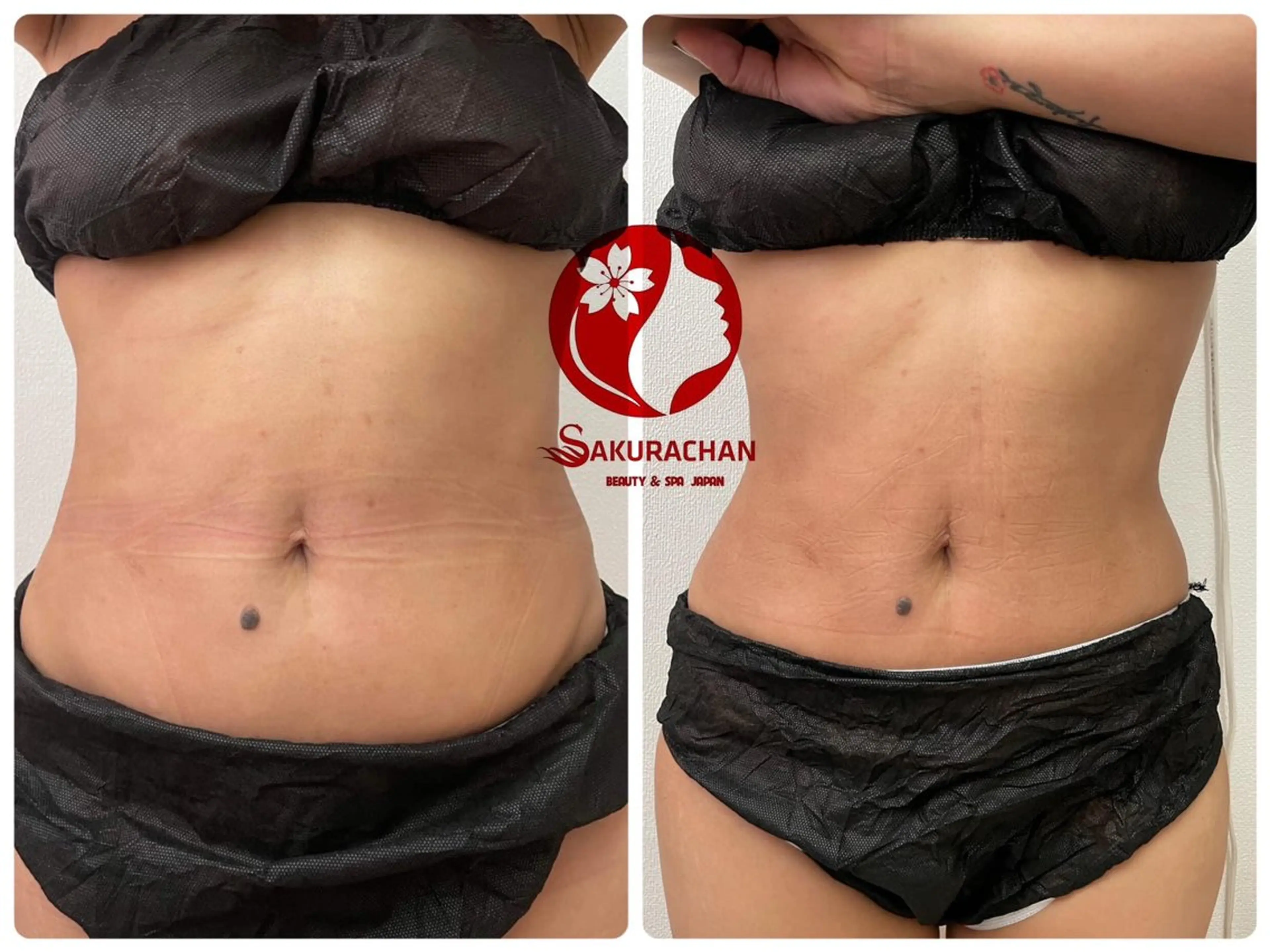 美肌，美ボディ，脱毛 サクラチャンスパのエステ・リラクイメージ