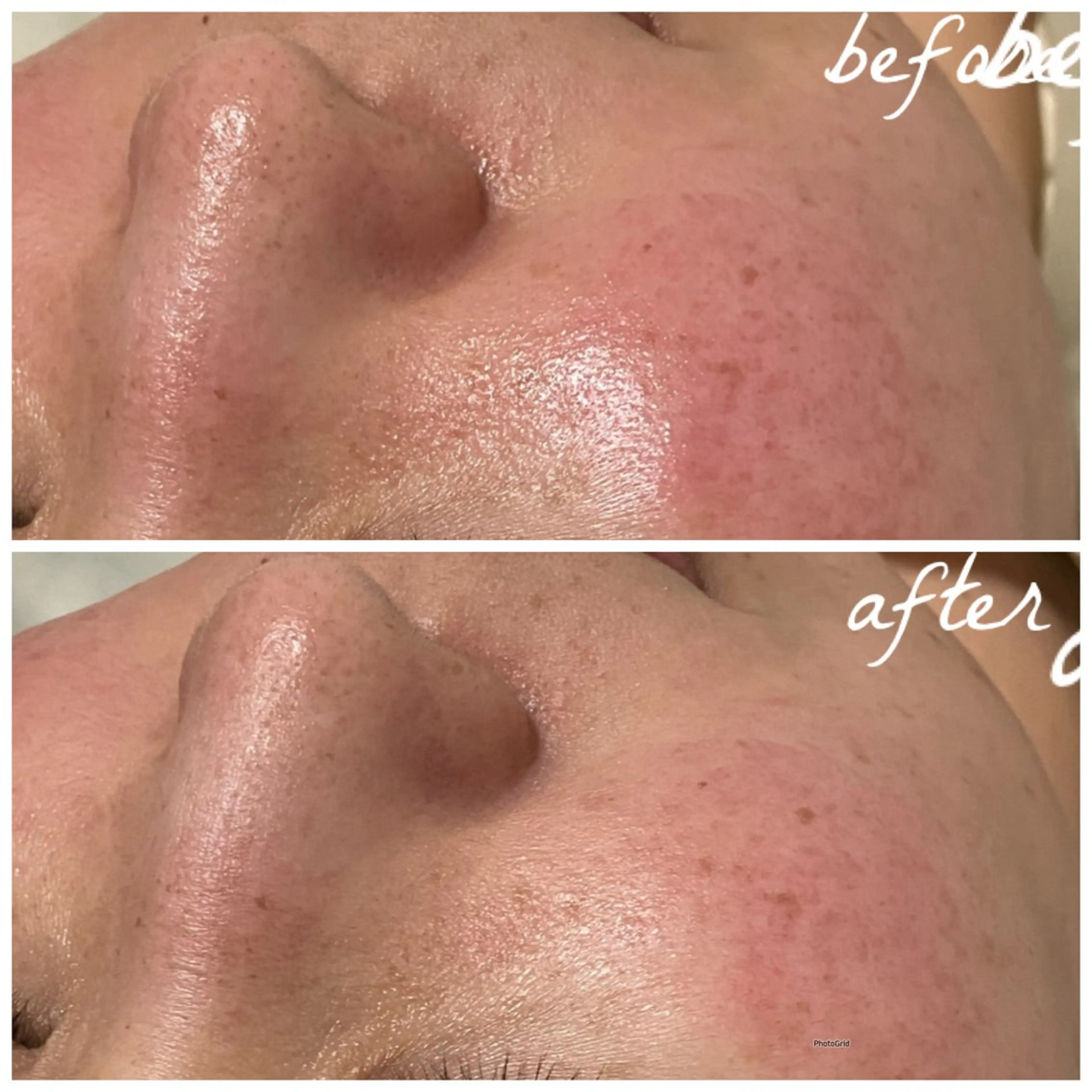 メンズ エステ メナード岐阜茜部 杉浦のエステ・リラクイメージ