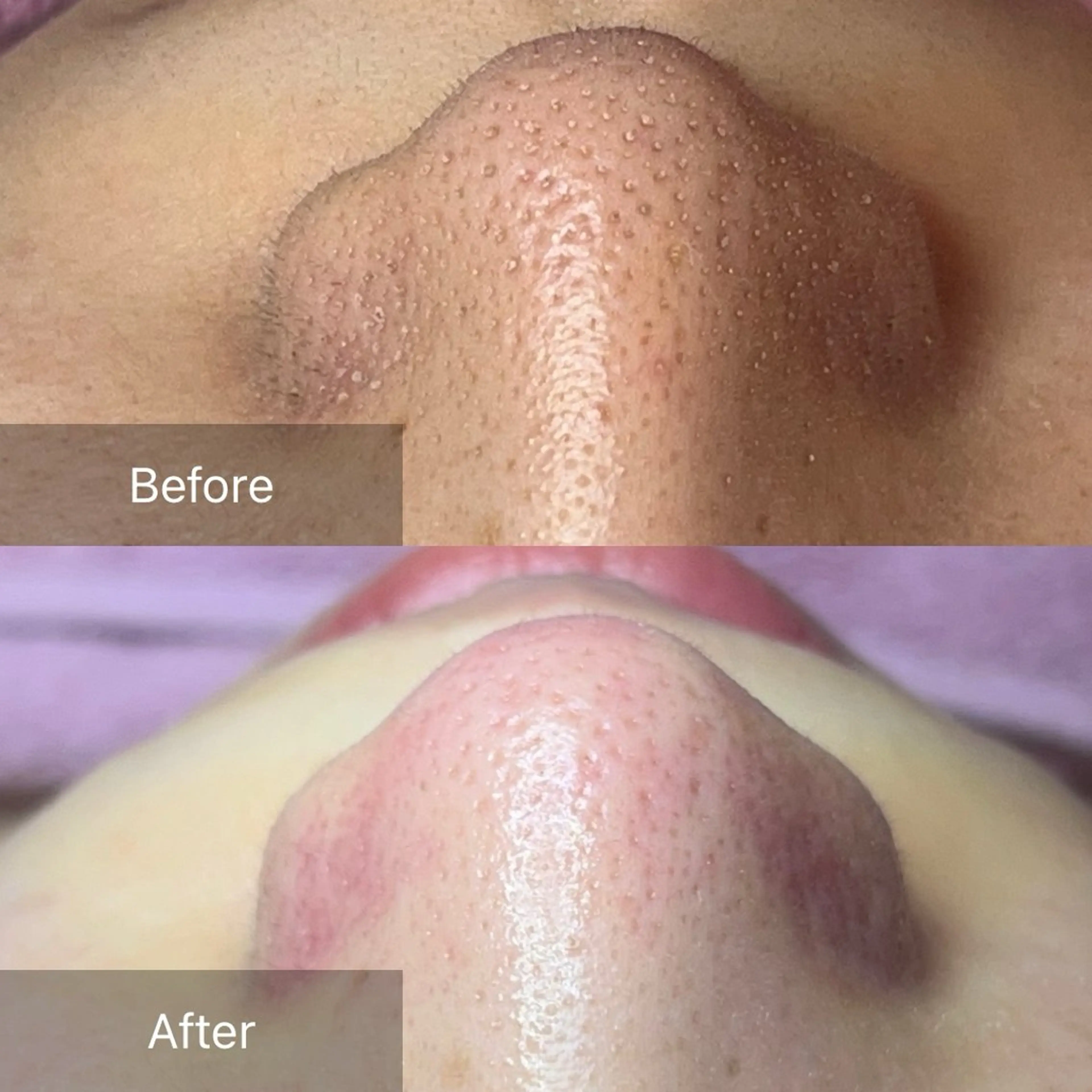 エステ ielu〜毛穴ケア ハーブピーリングのエステ・リラクイメージ