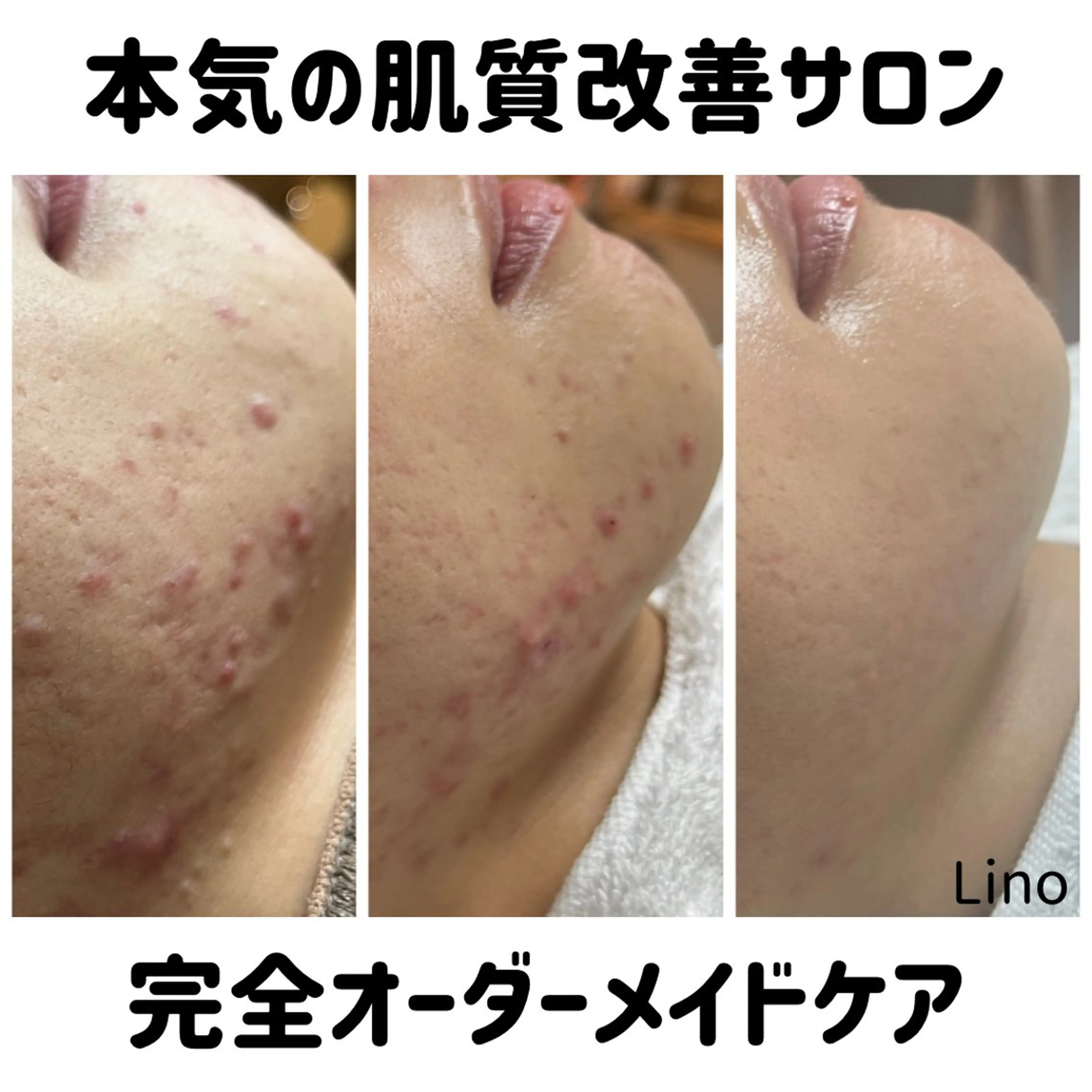 平日昼間限定★ 全メニュ¥6600のエステ・リラクイメージ