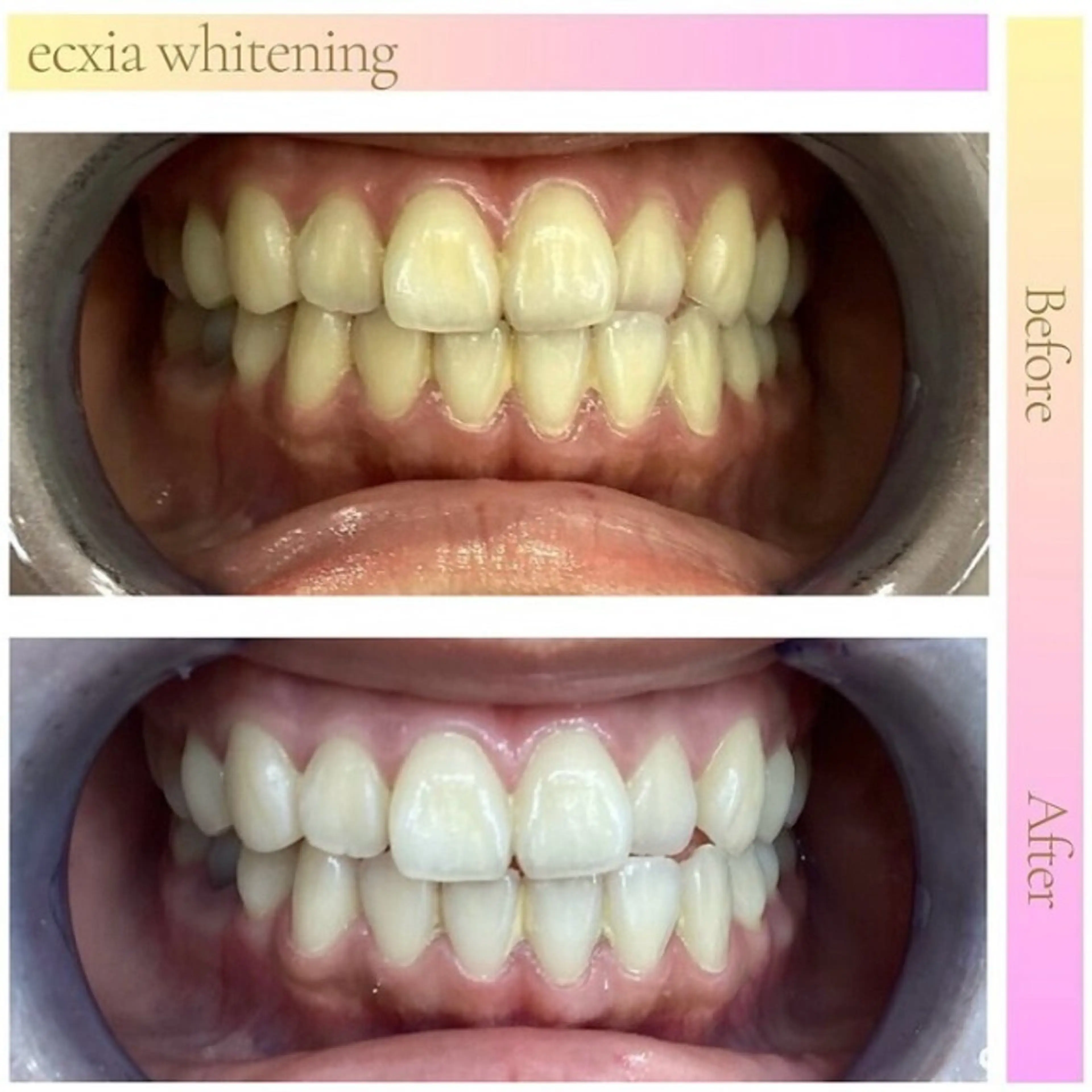 エクシアホワイト 伊勢崎店のその他イメージ