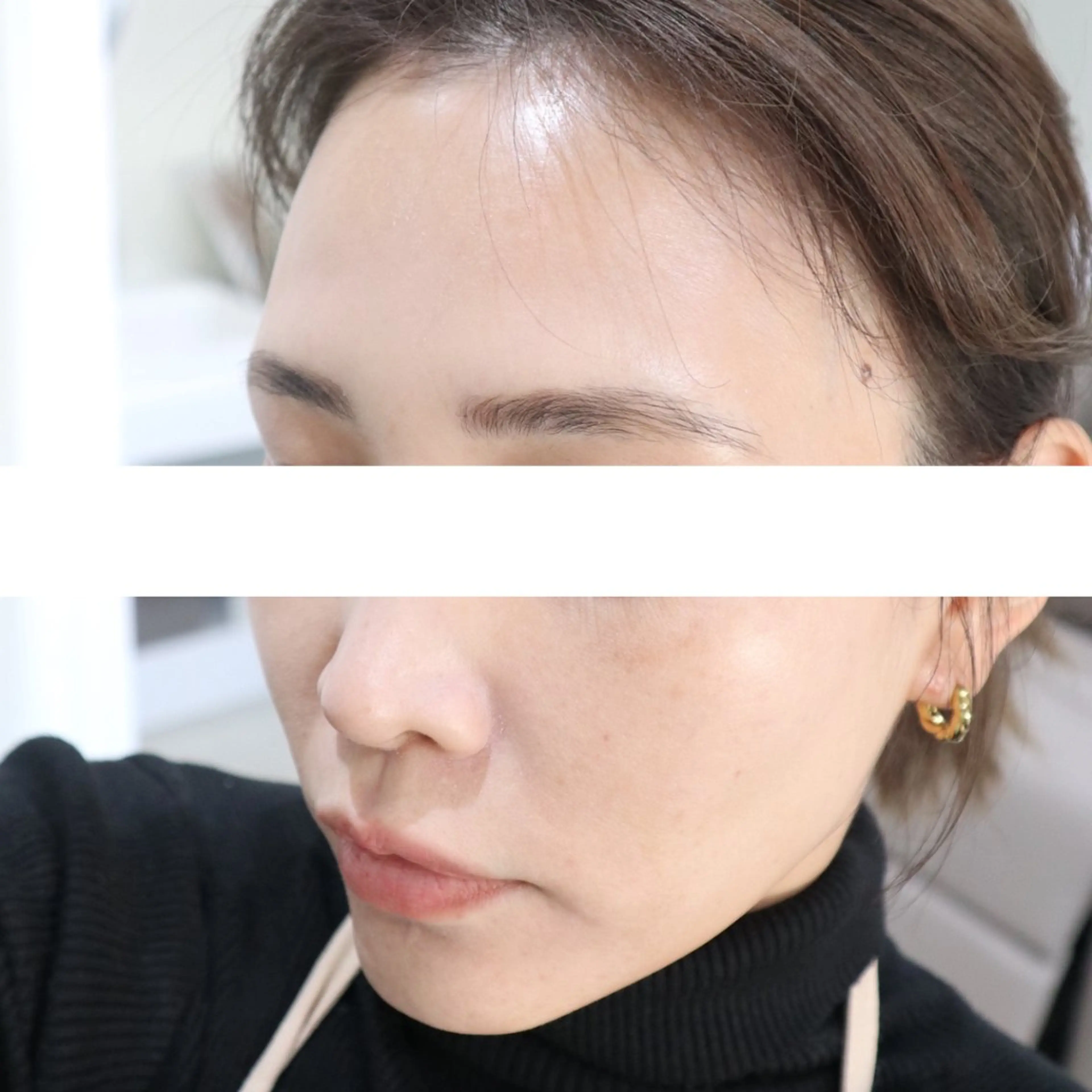 MY FAIR LADY所属・毛穴に特化したサロン MYFAIRLADYのエステ・リラクイメージ