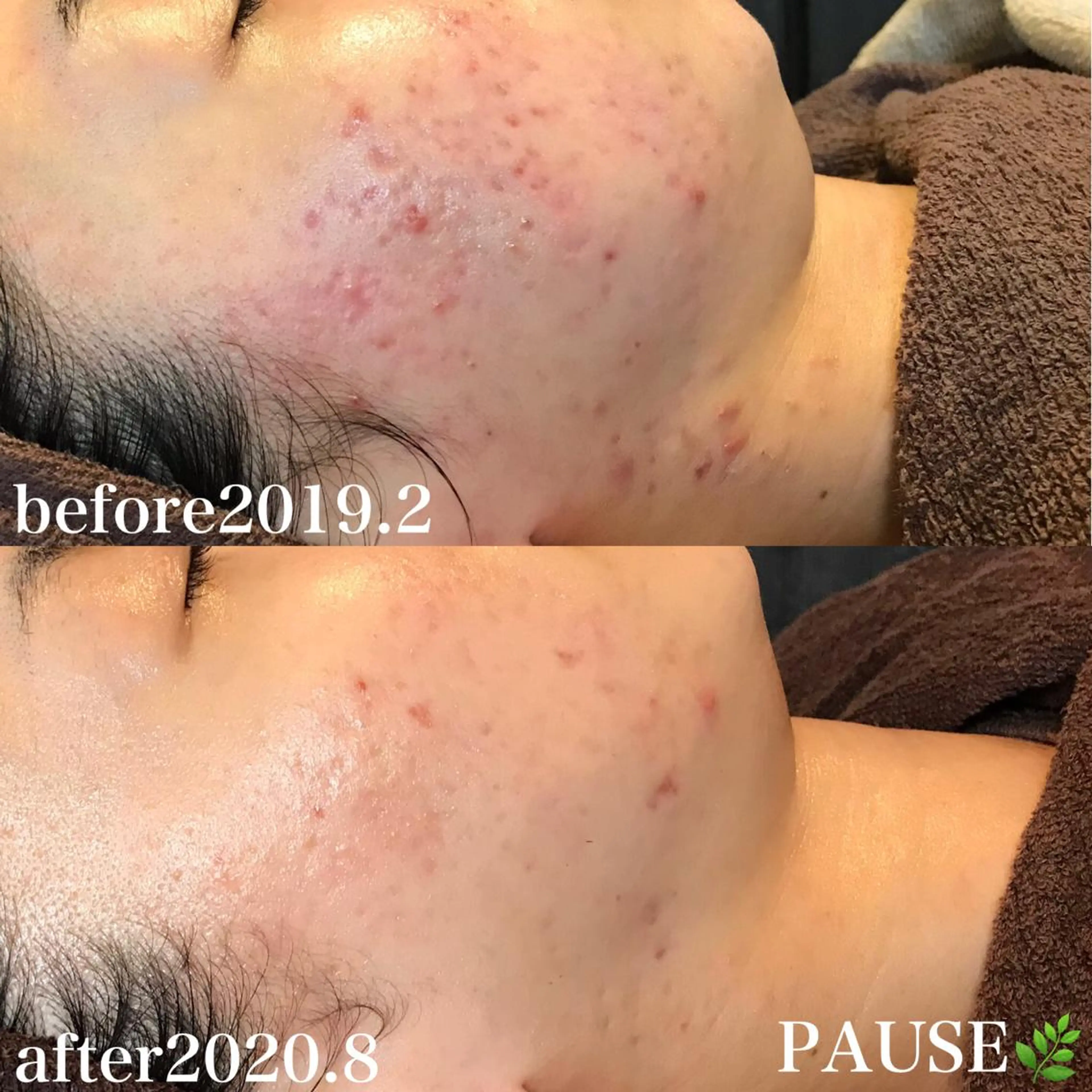 エステ 浜野 恵美のエステ・リラクイメージ