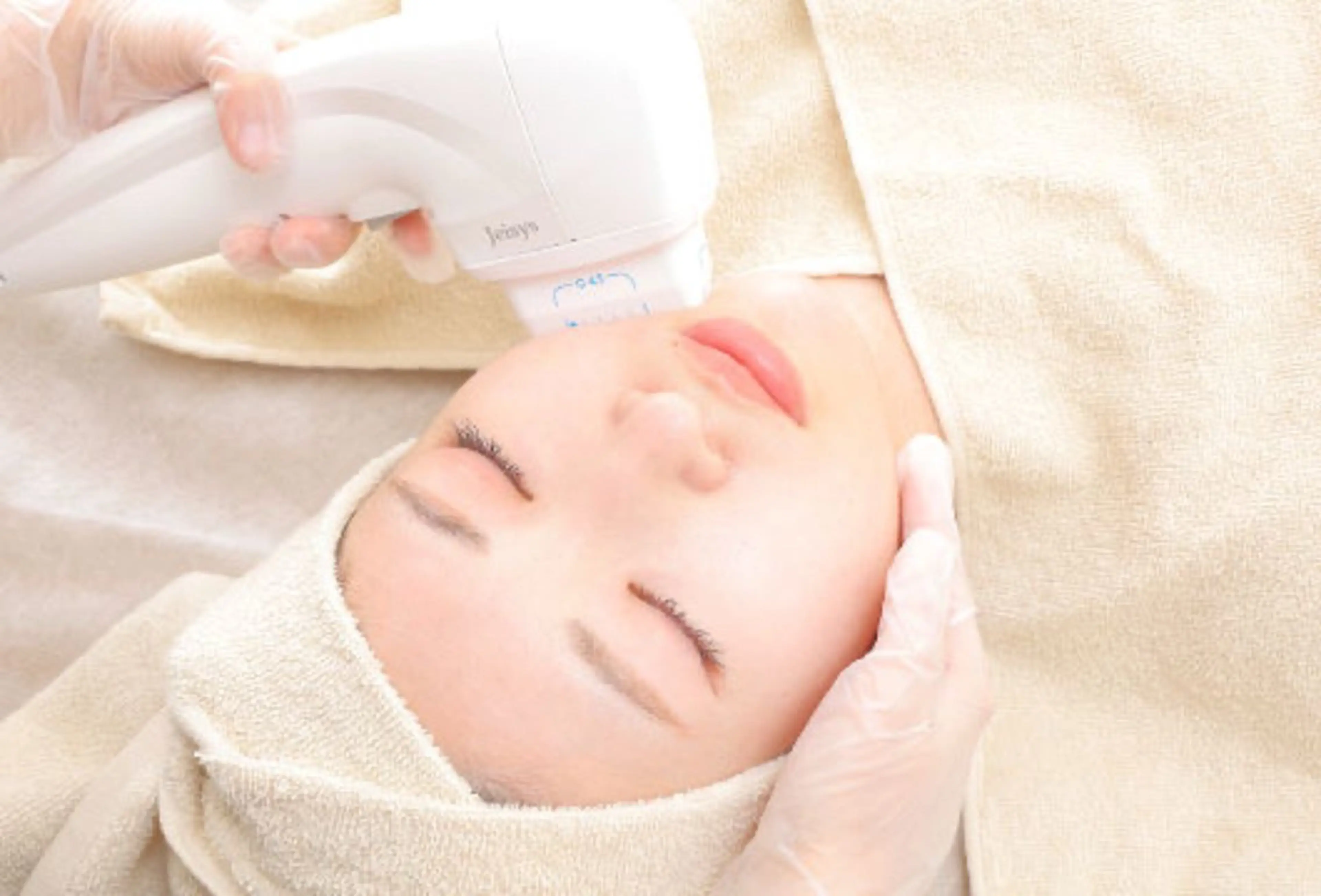 全顔脱毛　美肌/毛穴の引き締めにも◎の写真