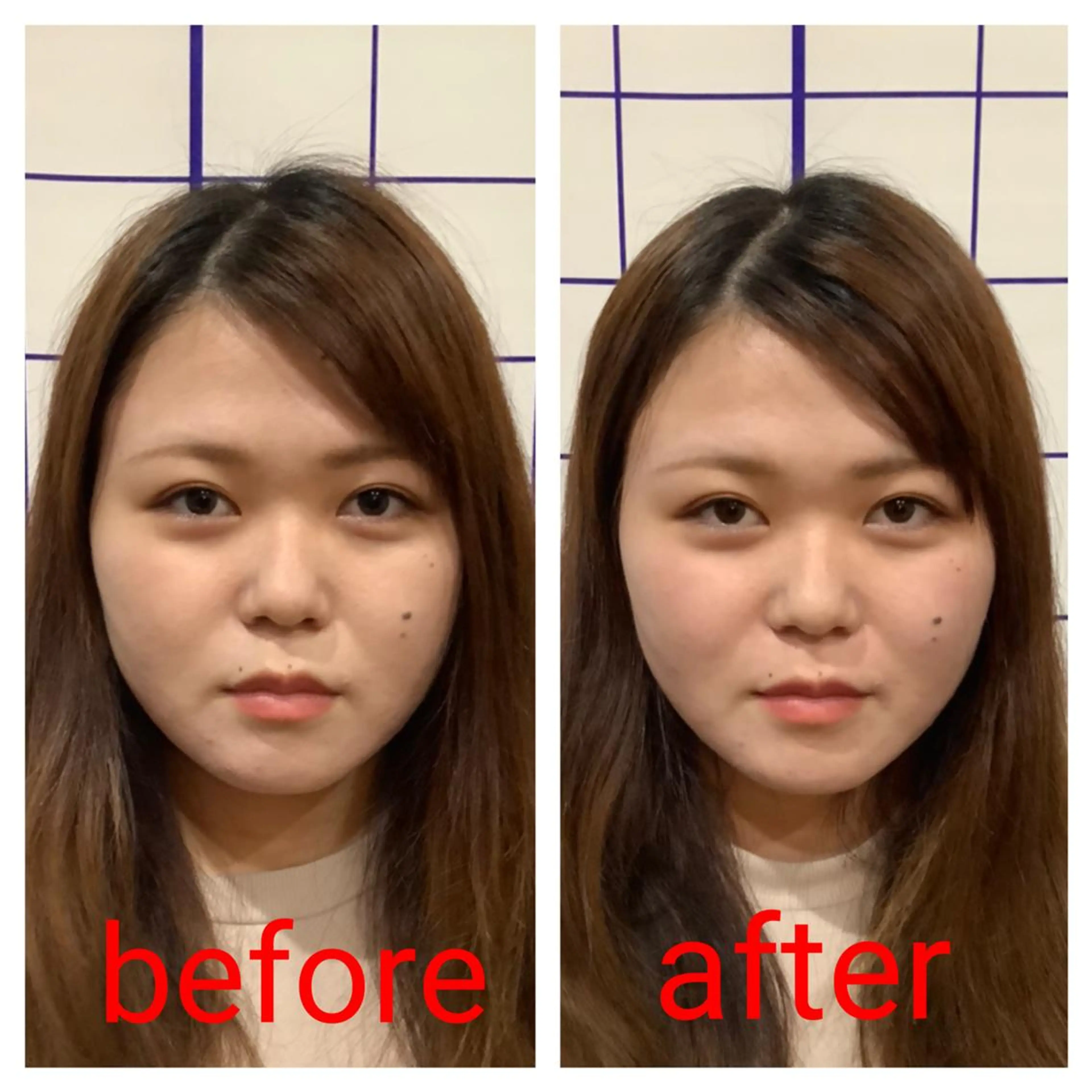 お顔のむくみたるみ 専門☆美容鍼小顔矯正のエステ・リラクイメージ