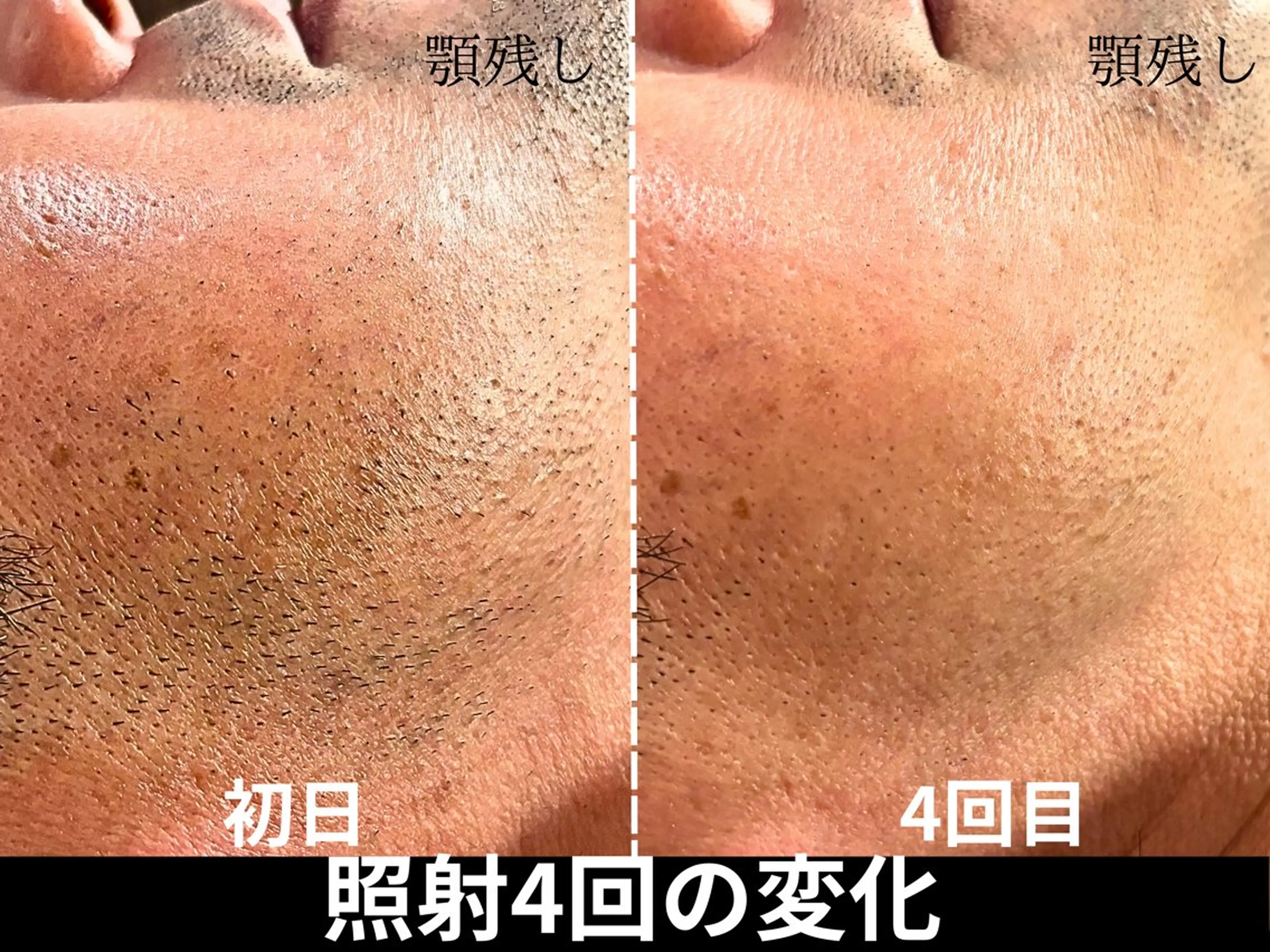 脱毛 脱毛サロン FIS武蔵小杉店のエステ・リラクイメージ