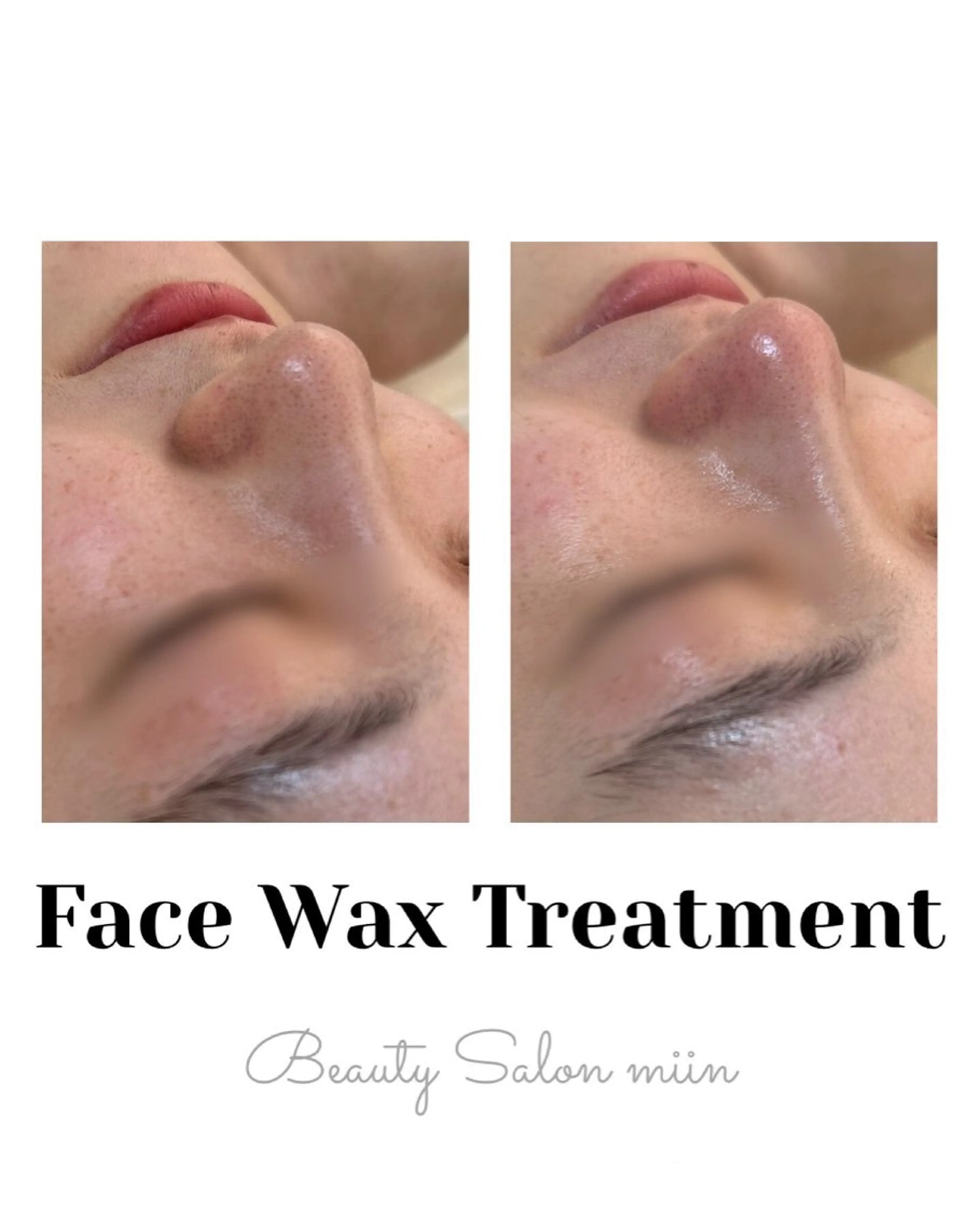 リラク 韓国肌管理 白玉肌管理®︎のエステ・リラクイメージ