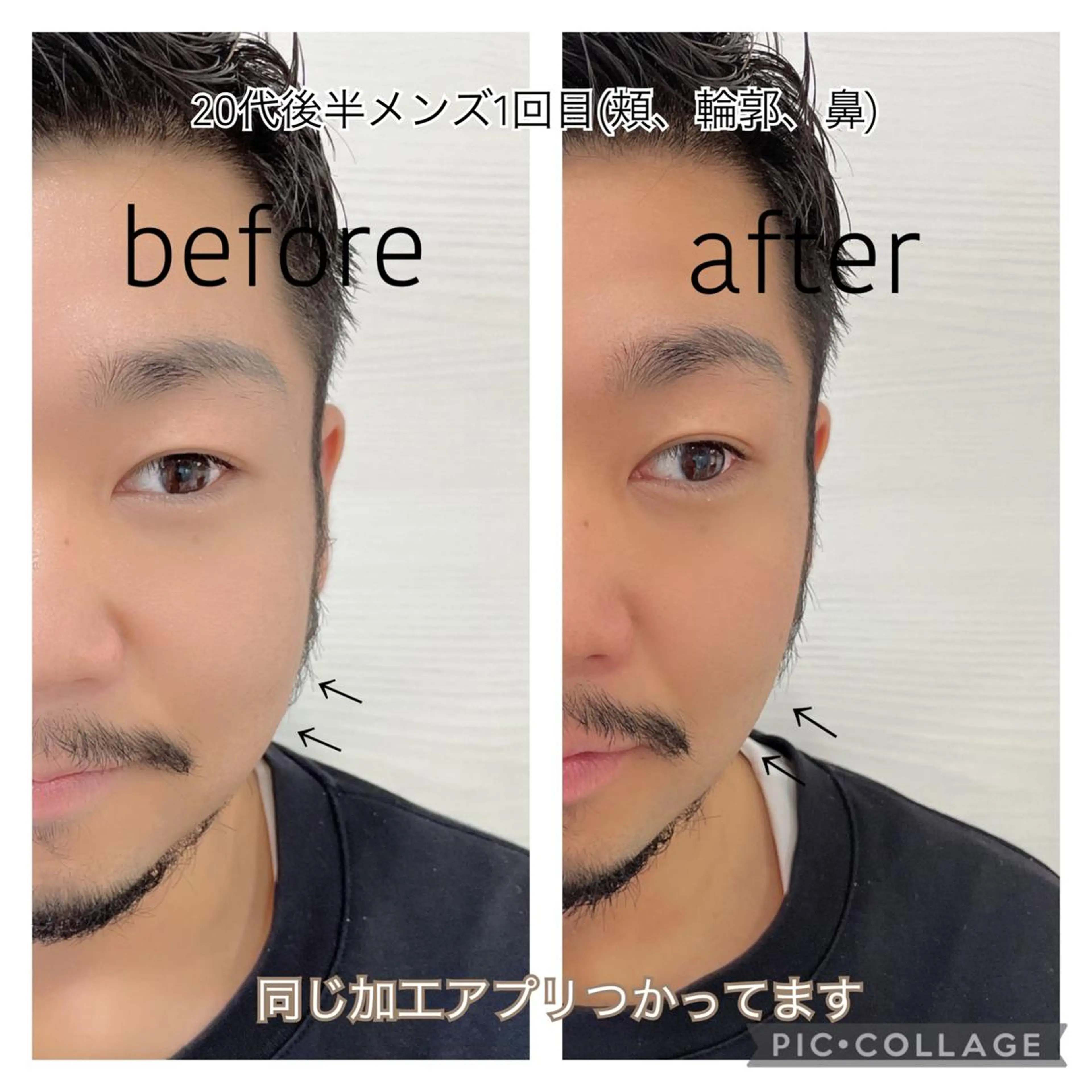 エステ ENCHANT 脱毛.小顔.毛穴のエステ・リラクイメージ