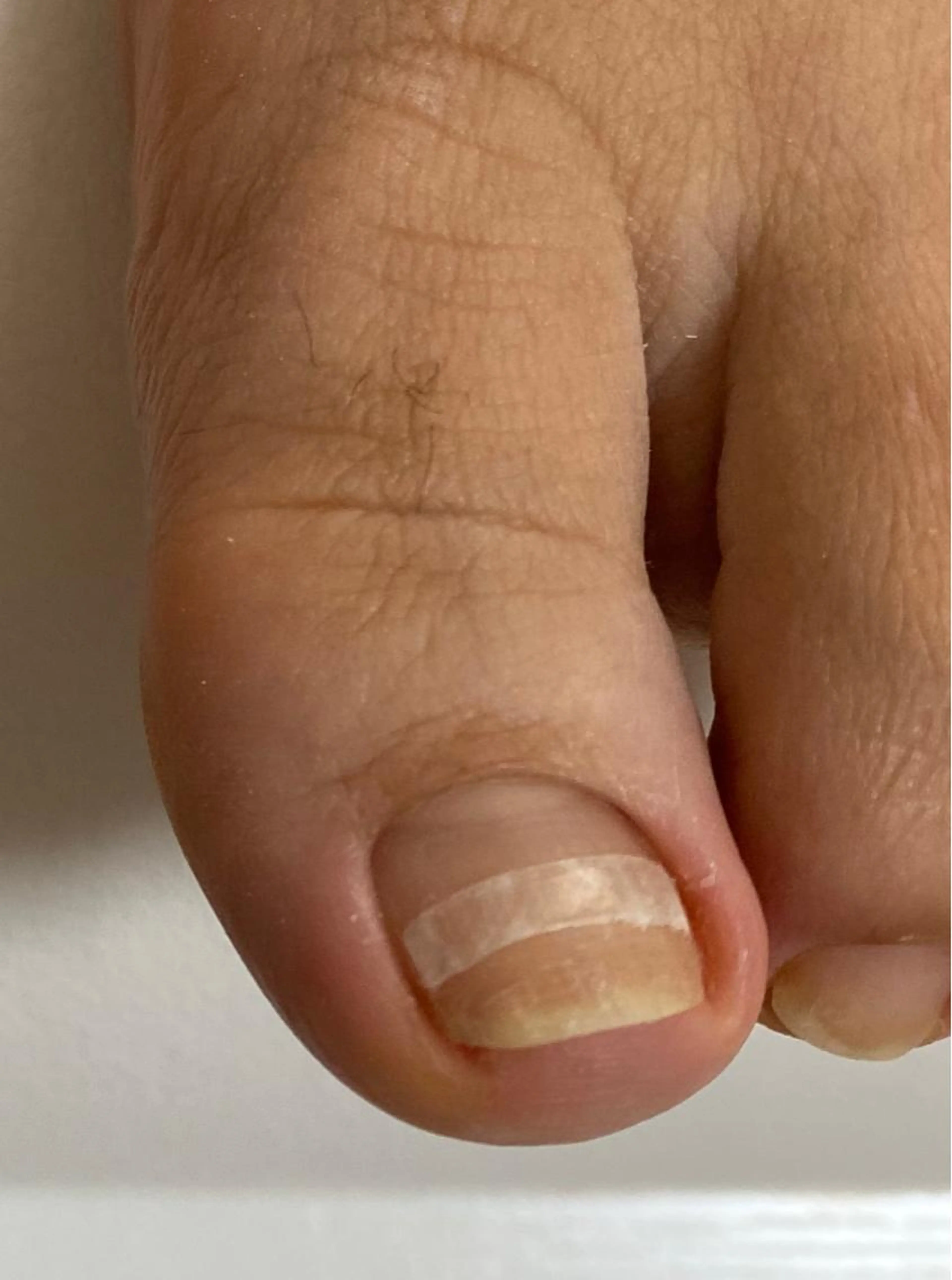 フットケア☆フット甘皮ケアします☆フットバス付き☆の写真