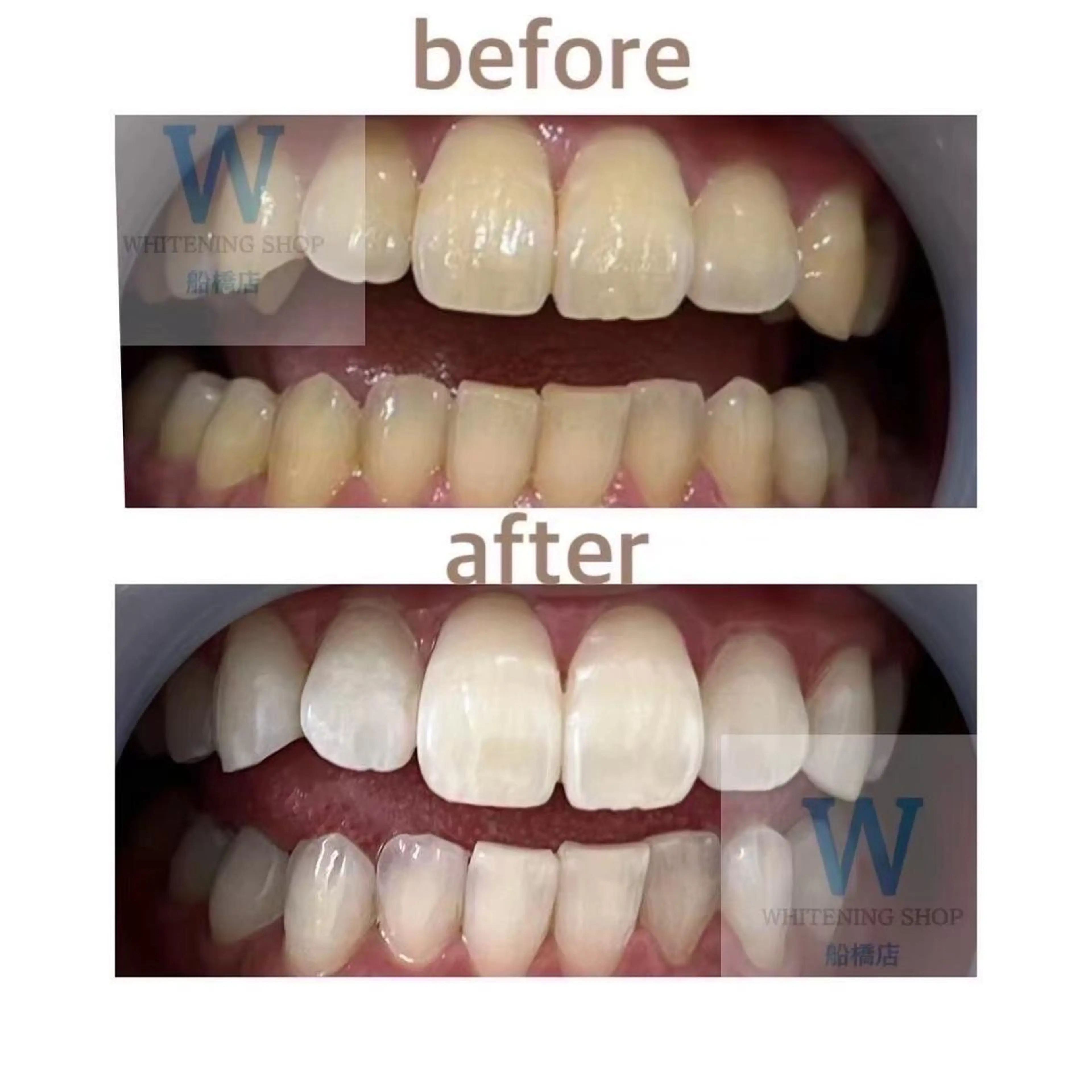 ホワイトニング ショップ船橋店🦷のエステ・リラクイメージ