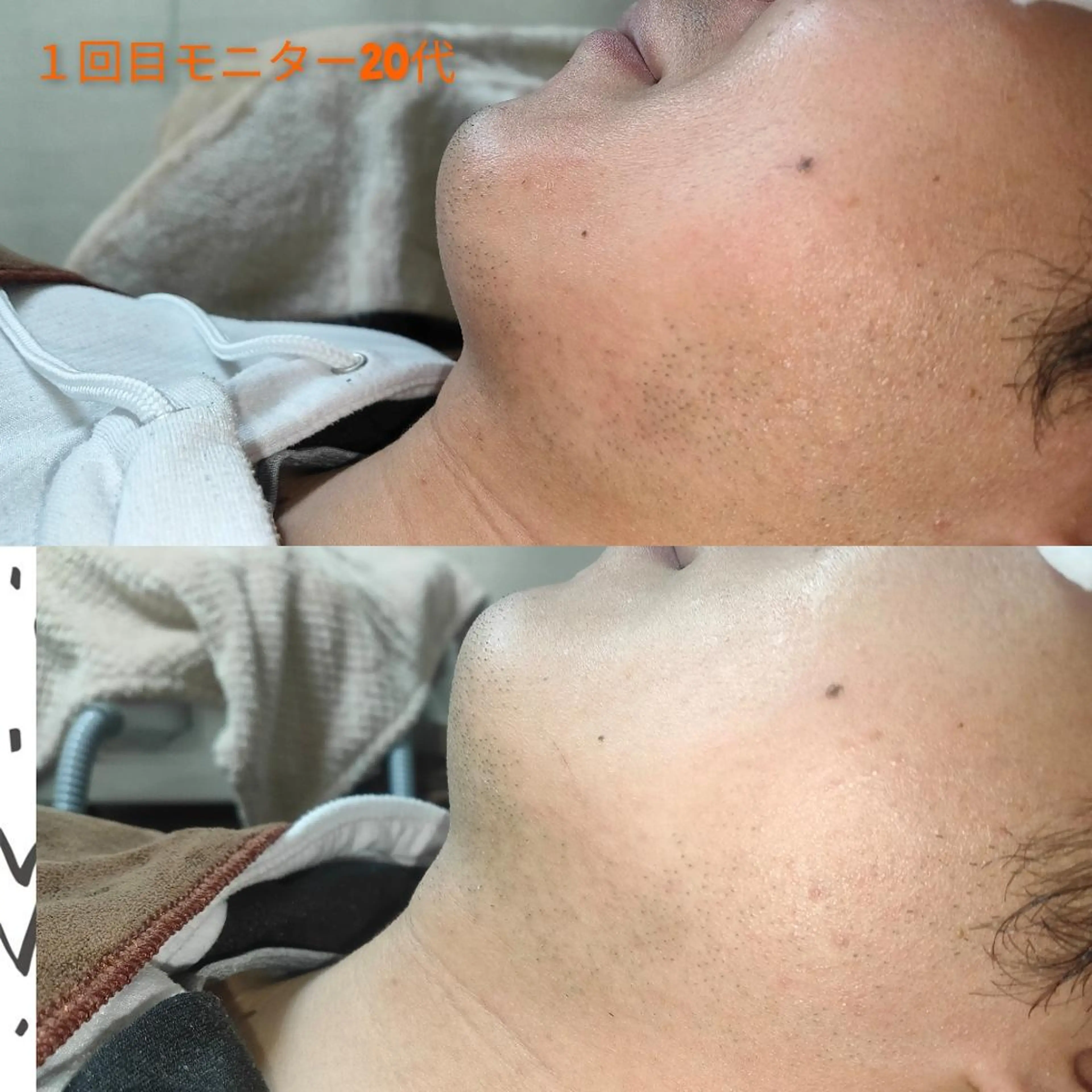 メンズ 脱毛 武 藤のエステ・リラクイメージ