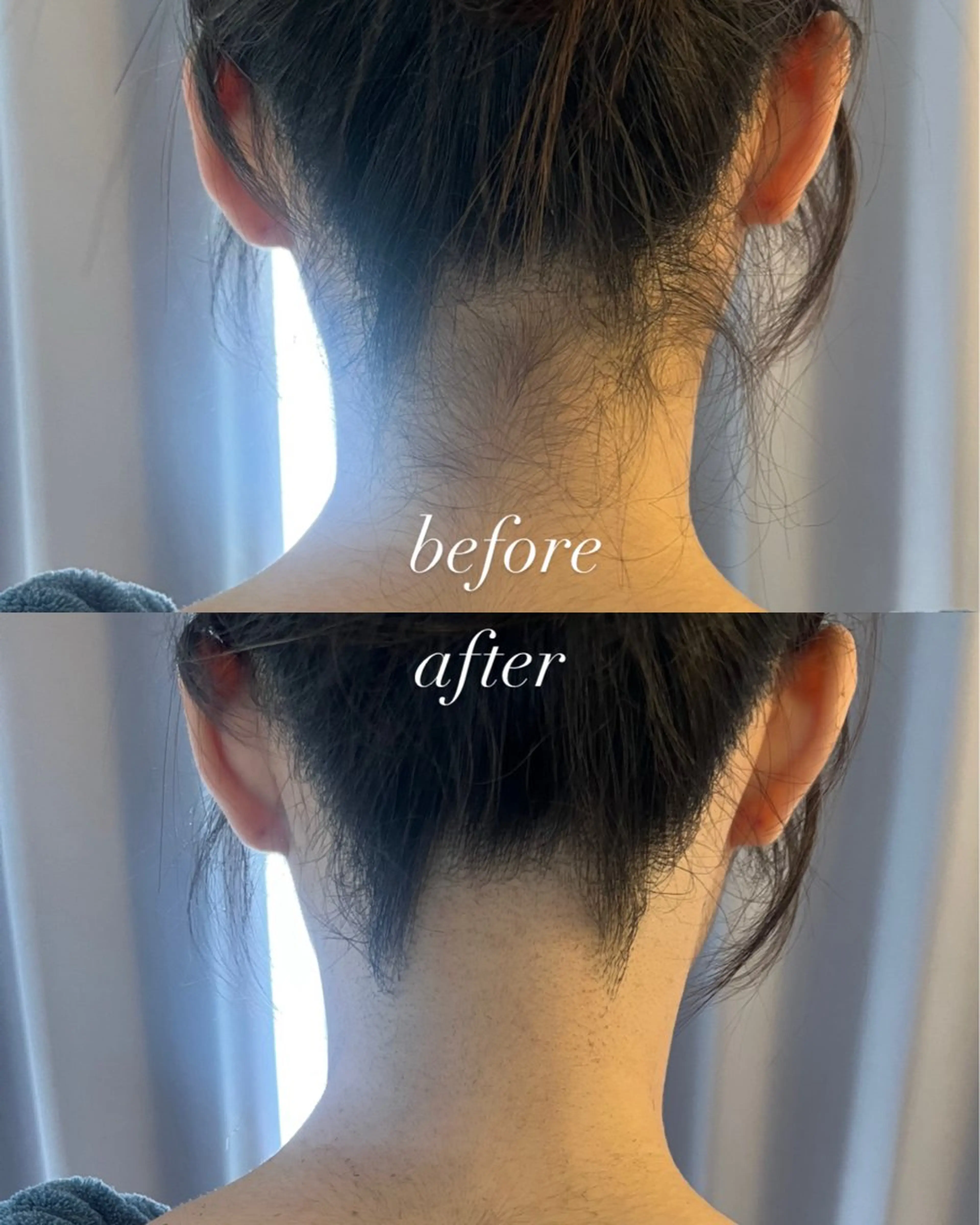 うなじ脱毛/美肌脱毛 LABELのエステ・リラクイメージ