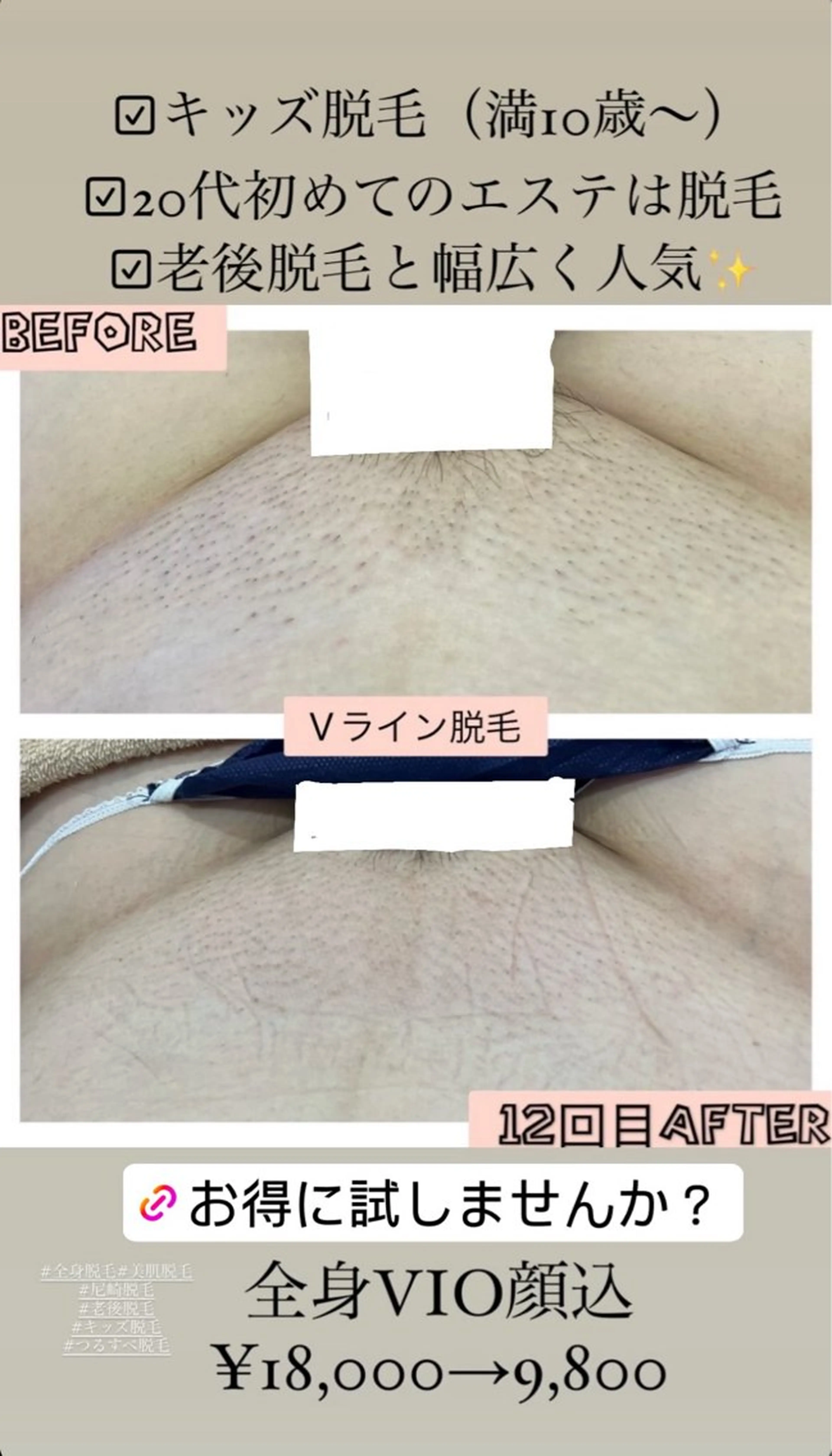 ブライダル痩身×脱毛 尼崎駅前サロンのエステ・リラクイメージ