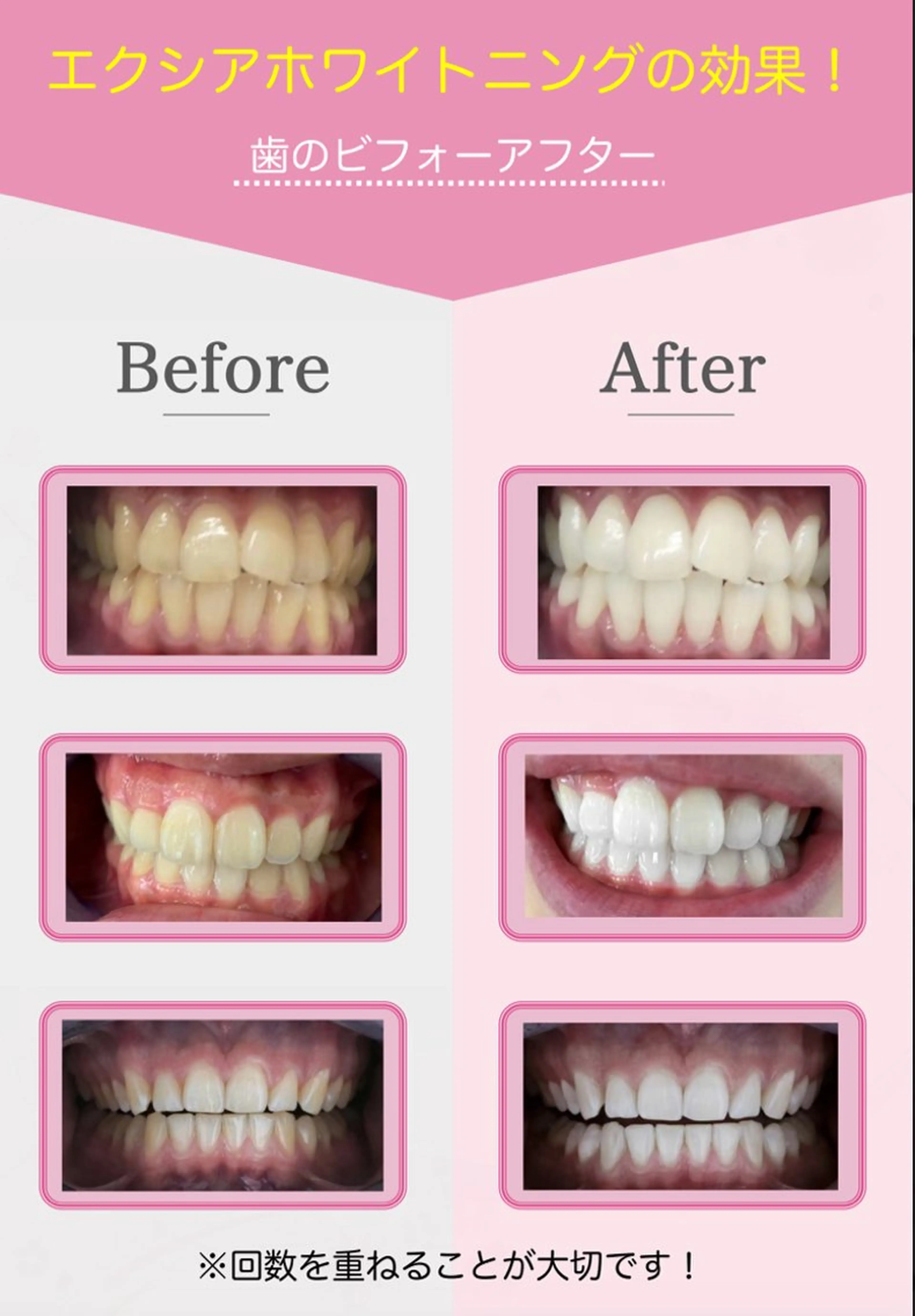 nanami -ホワイトニングのその他イメージ