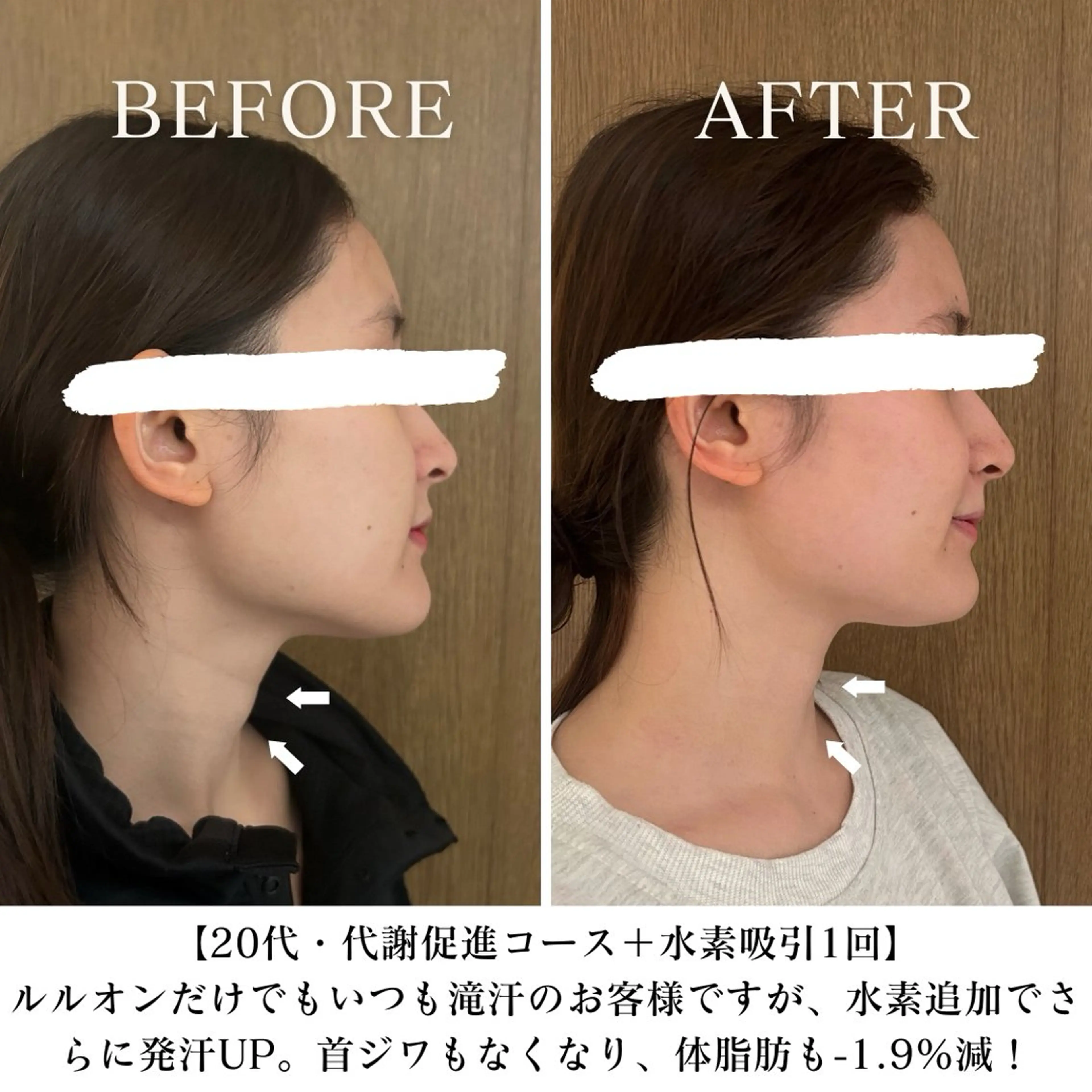 【再来】一番人気⭐︎ダイエット卒業コース！(水素吸入込み！)の写真