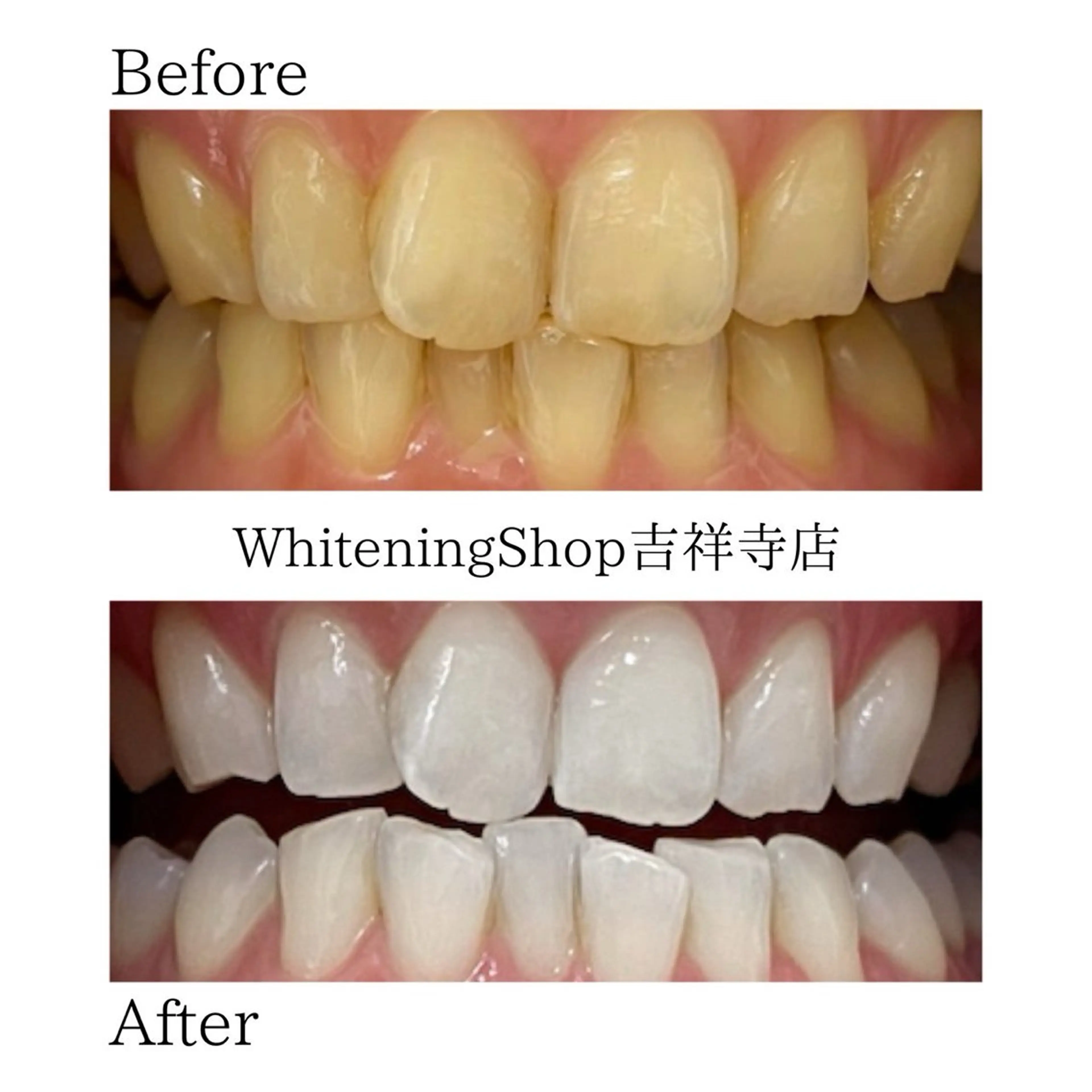 エステ リラク ホワイトニング ショップ吉祥寺店のエステ・リラクイメージ