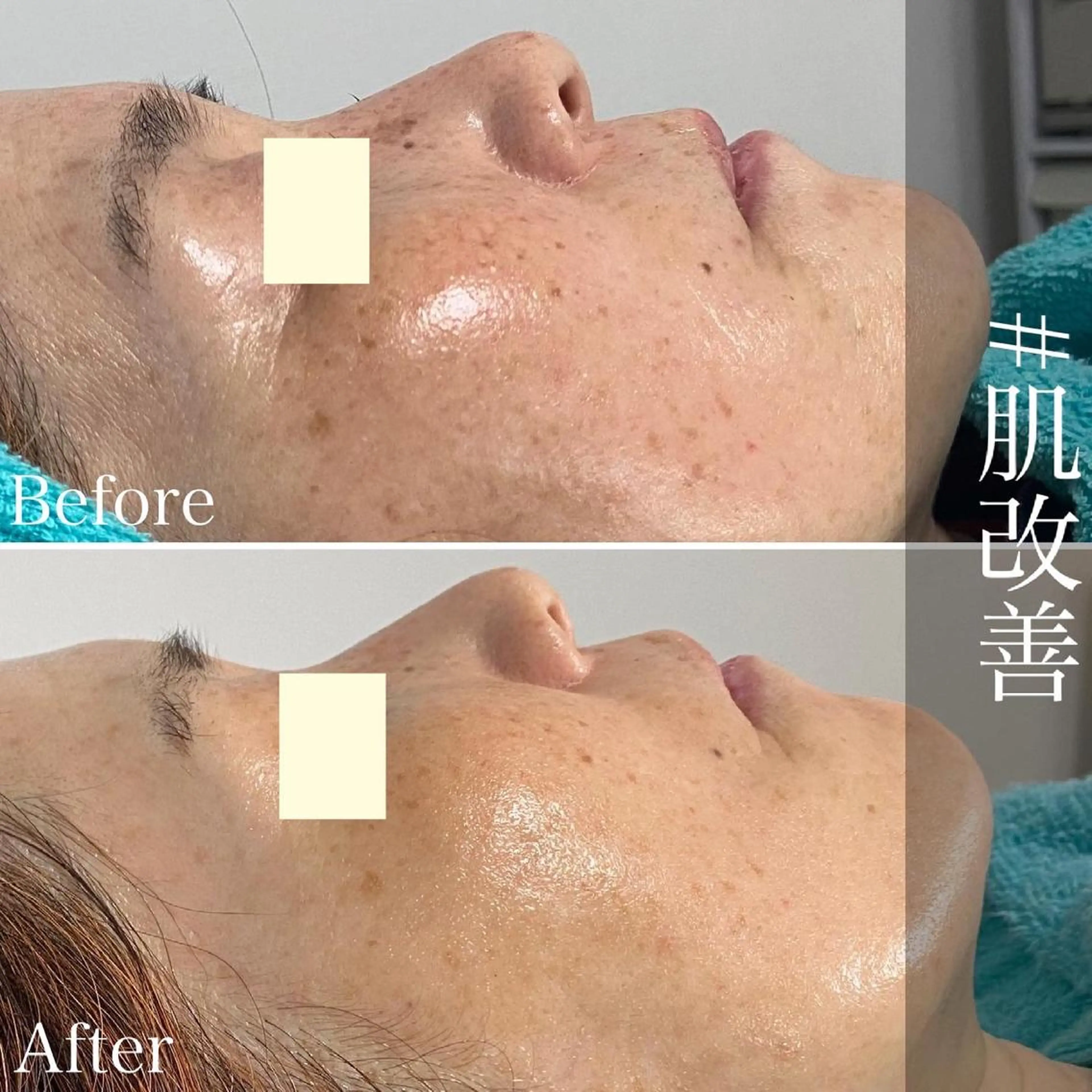 メンズ歓迎🙆‍♀️ エステ/ネイルISTのネイルデザイン