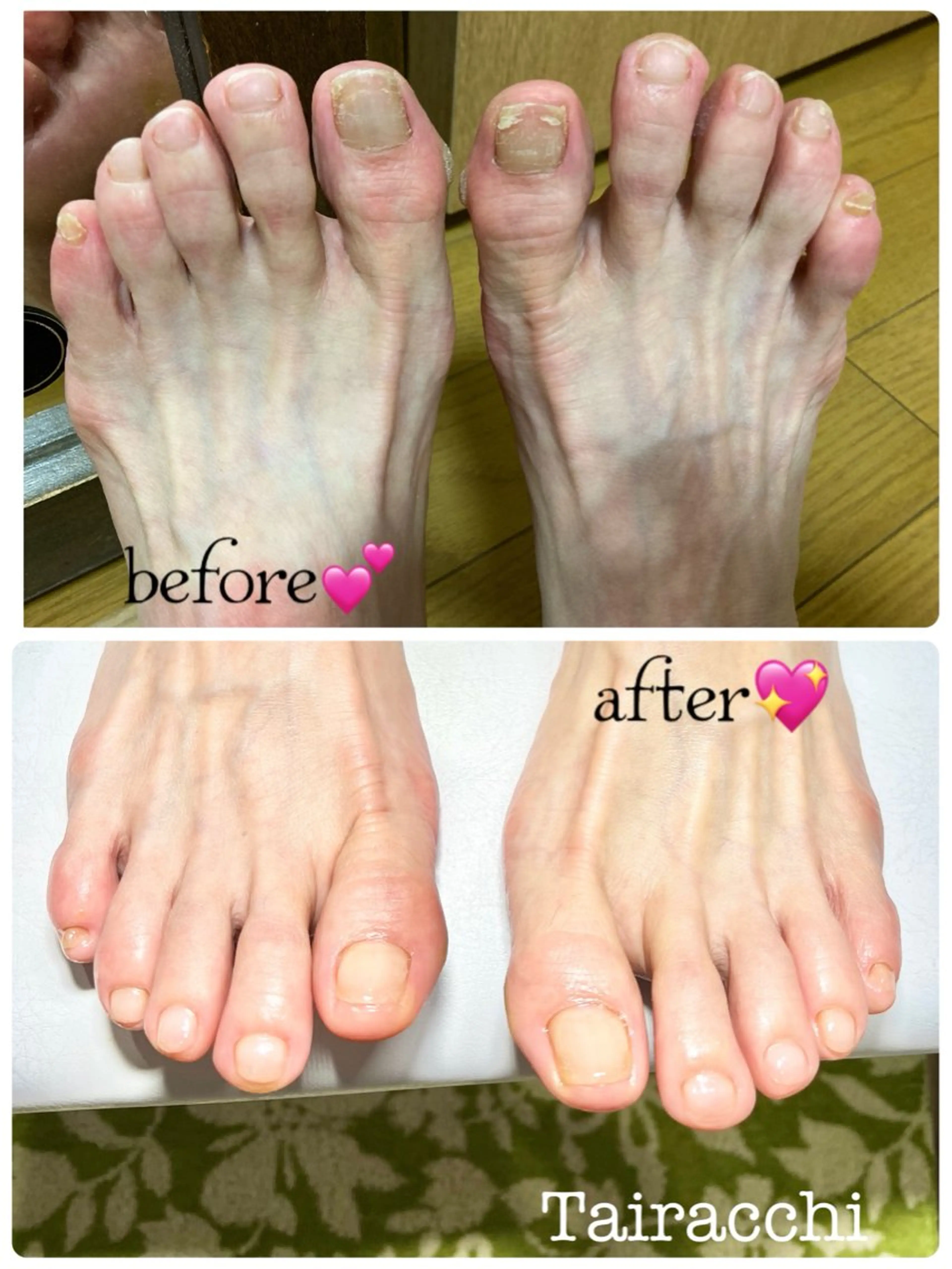 ネイル フットネイル フットネイル Tairacchi タイラッチのネイルデザイン