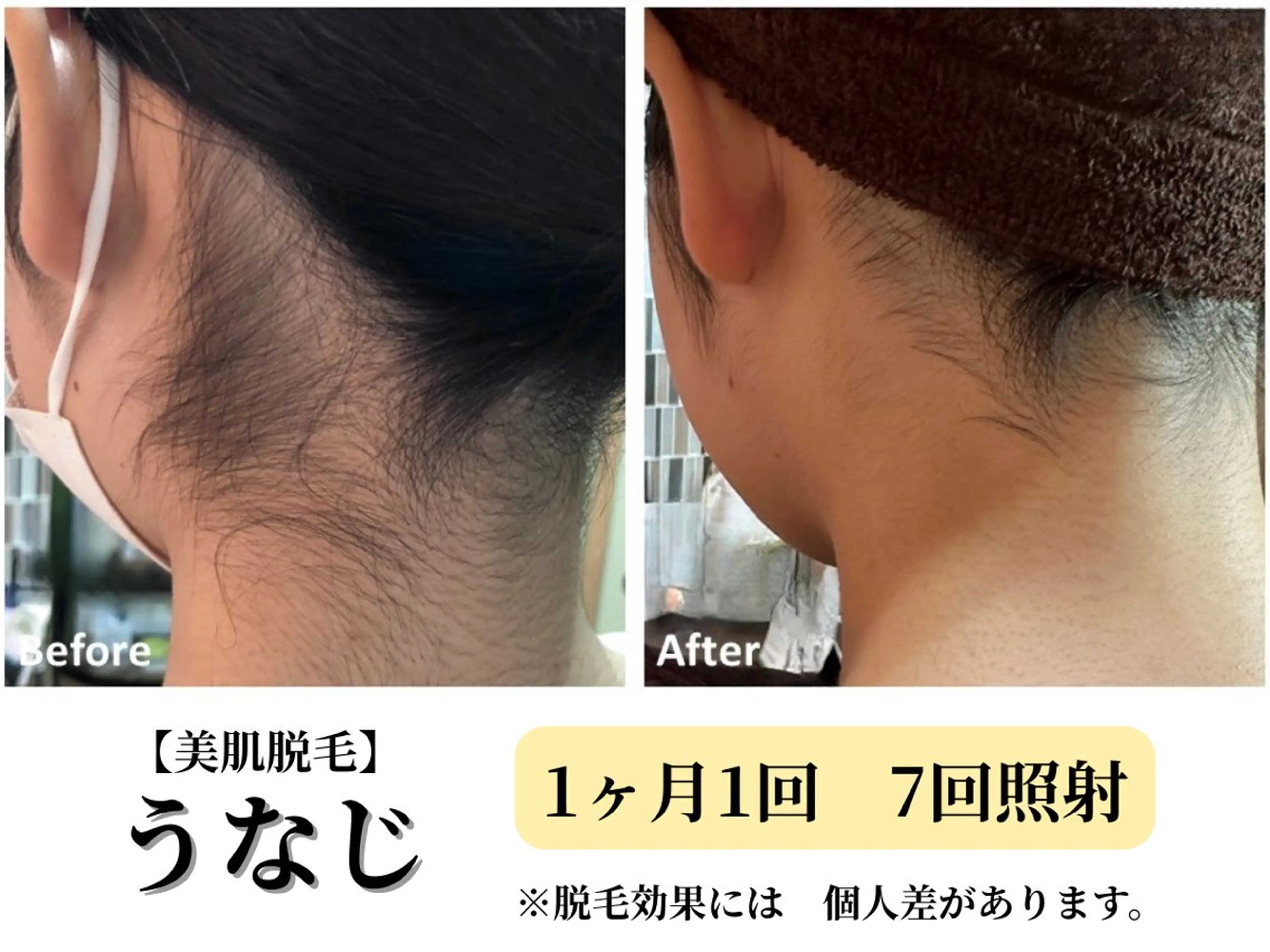 脱毛 Belle White所属・本格痩身＊透明美肌 BelleWhiteのエステ・リラクイメージ