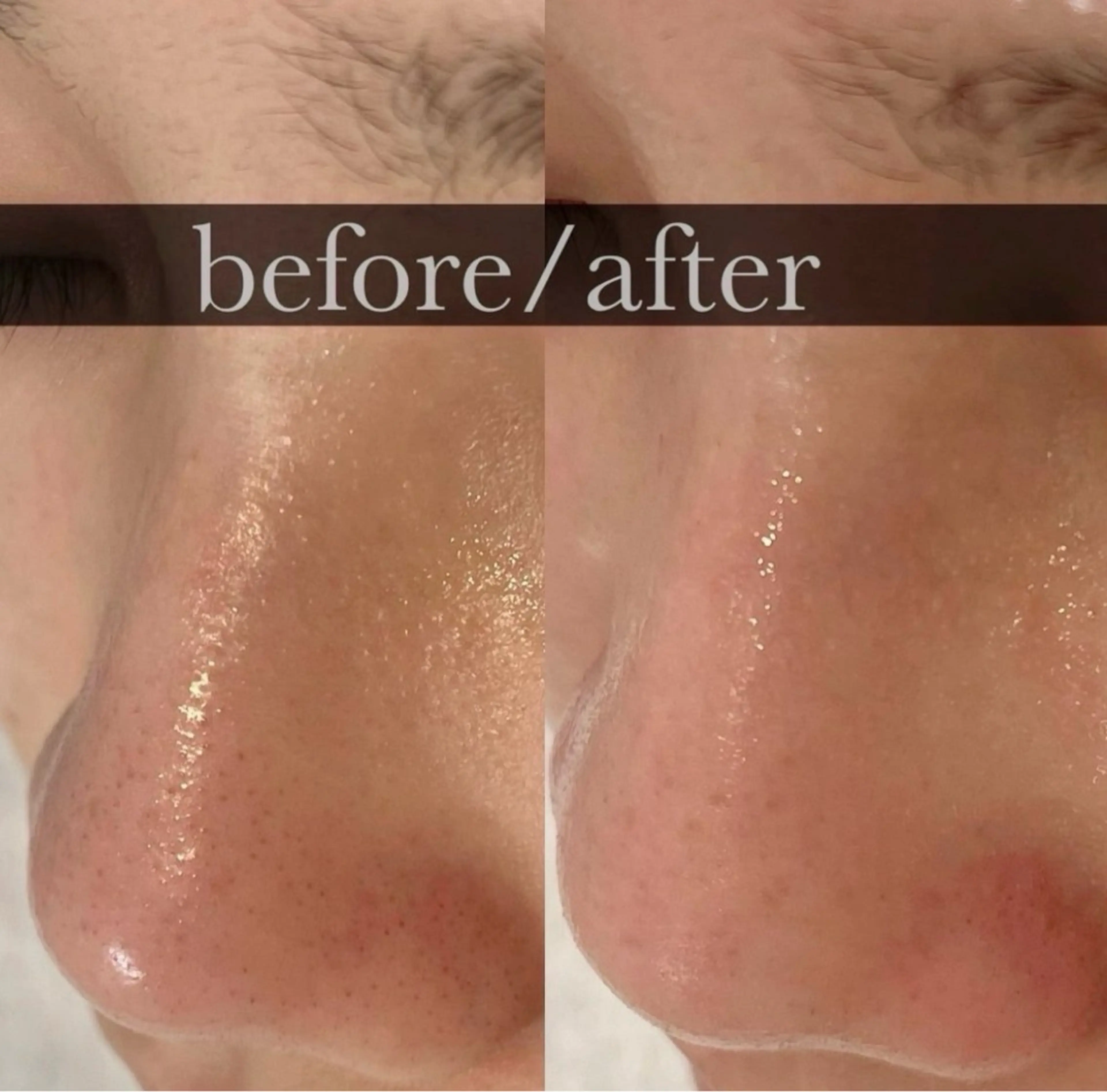 FOXYLASH inoueのエステ・リラクイメージ