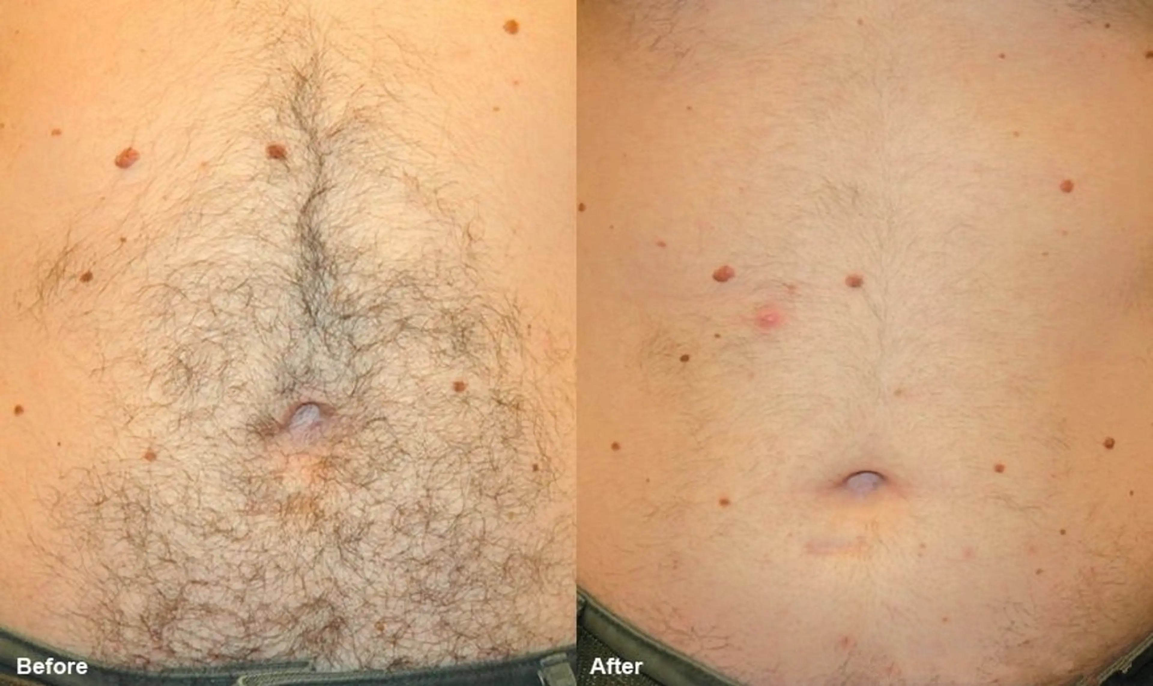 メンズ メンズ美肌脱毛 seekest.のエステ・リラクイメージ