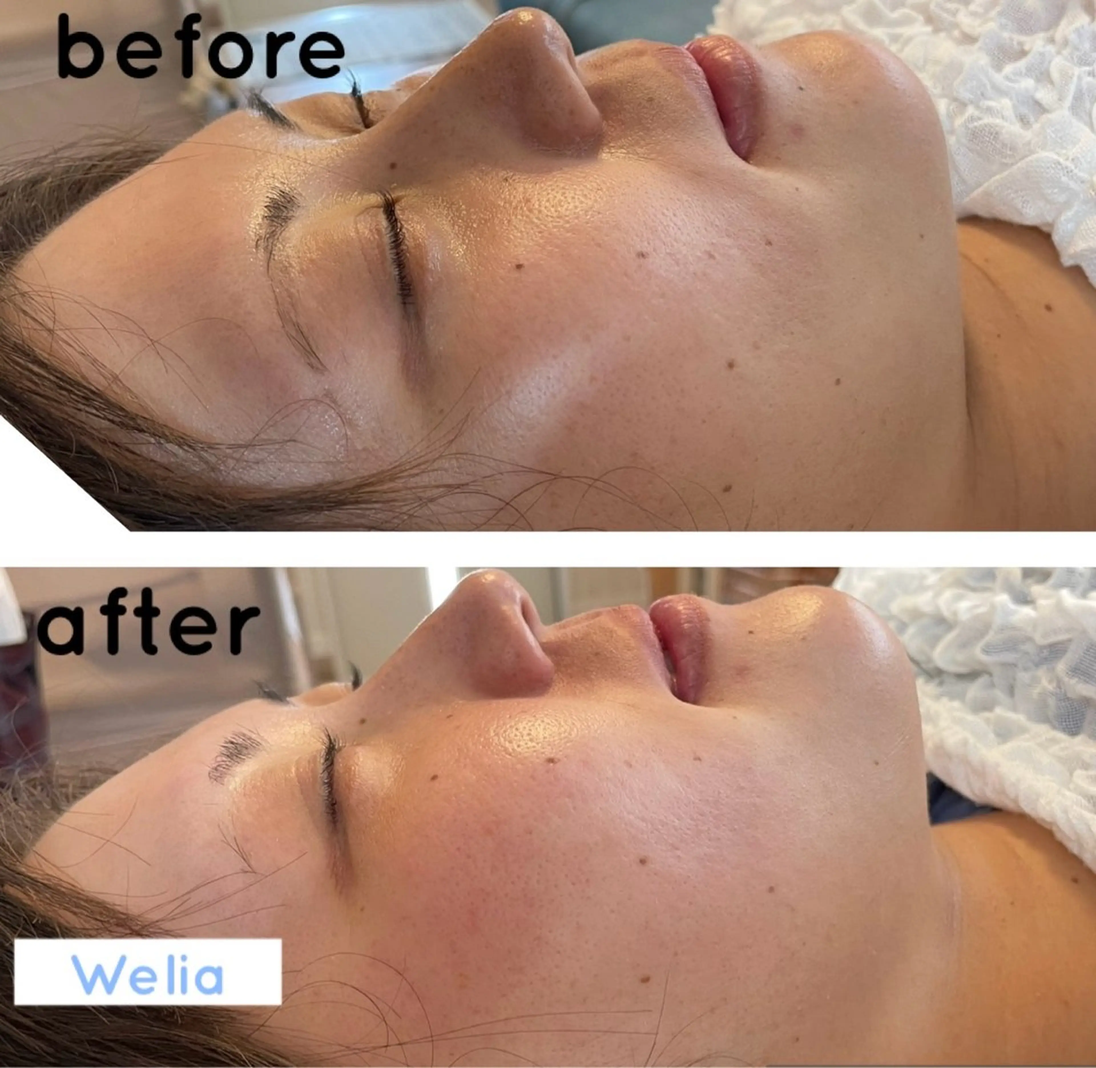 エステ ＊Welia＊ ウェリアのマツエク・マツパデザイン