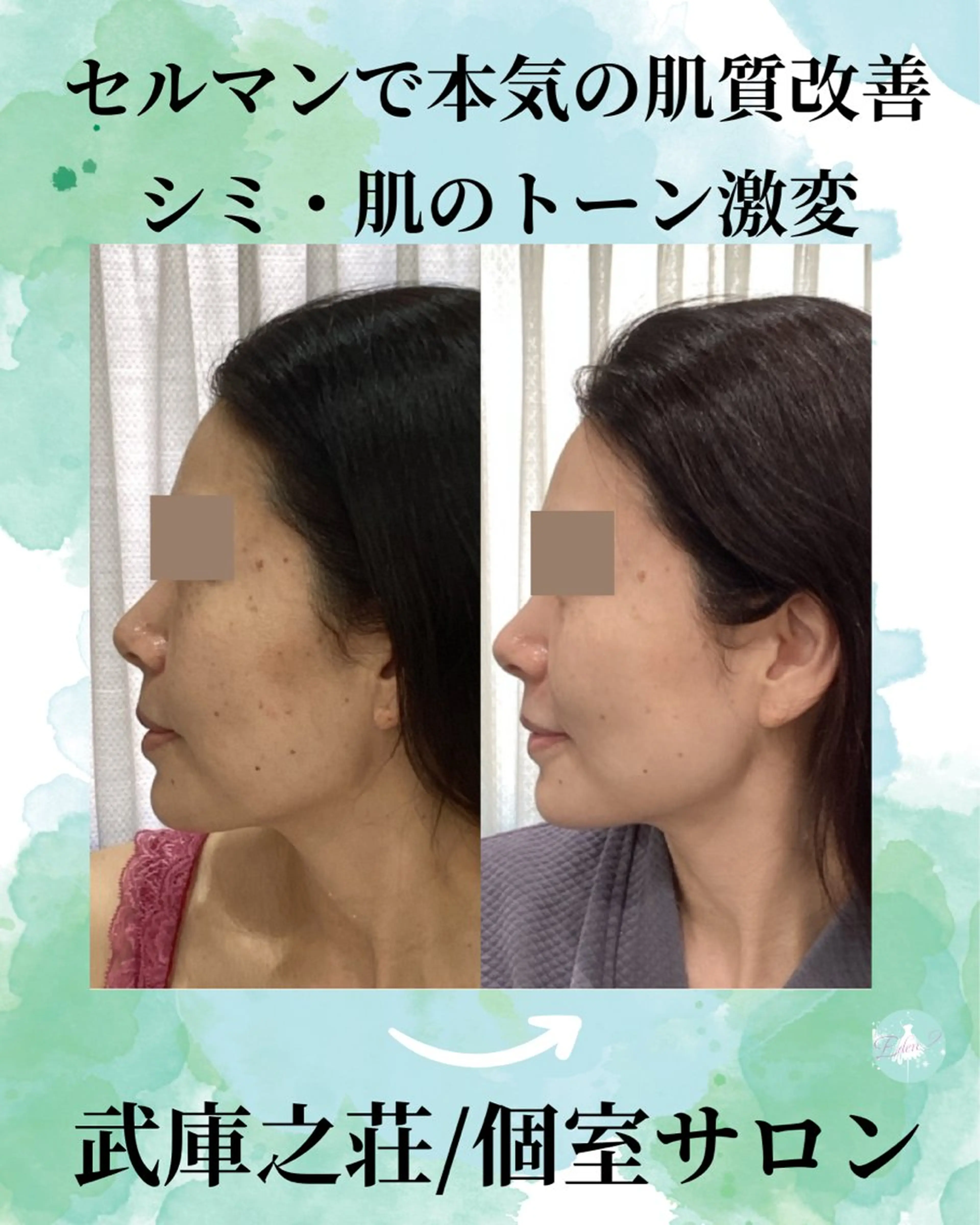 エステ♡Eden Asamiのエステ・リラクイメージ