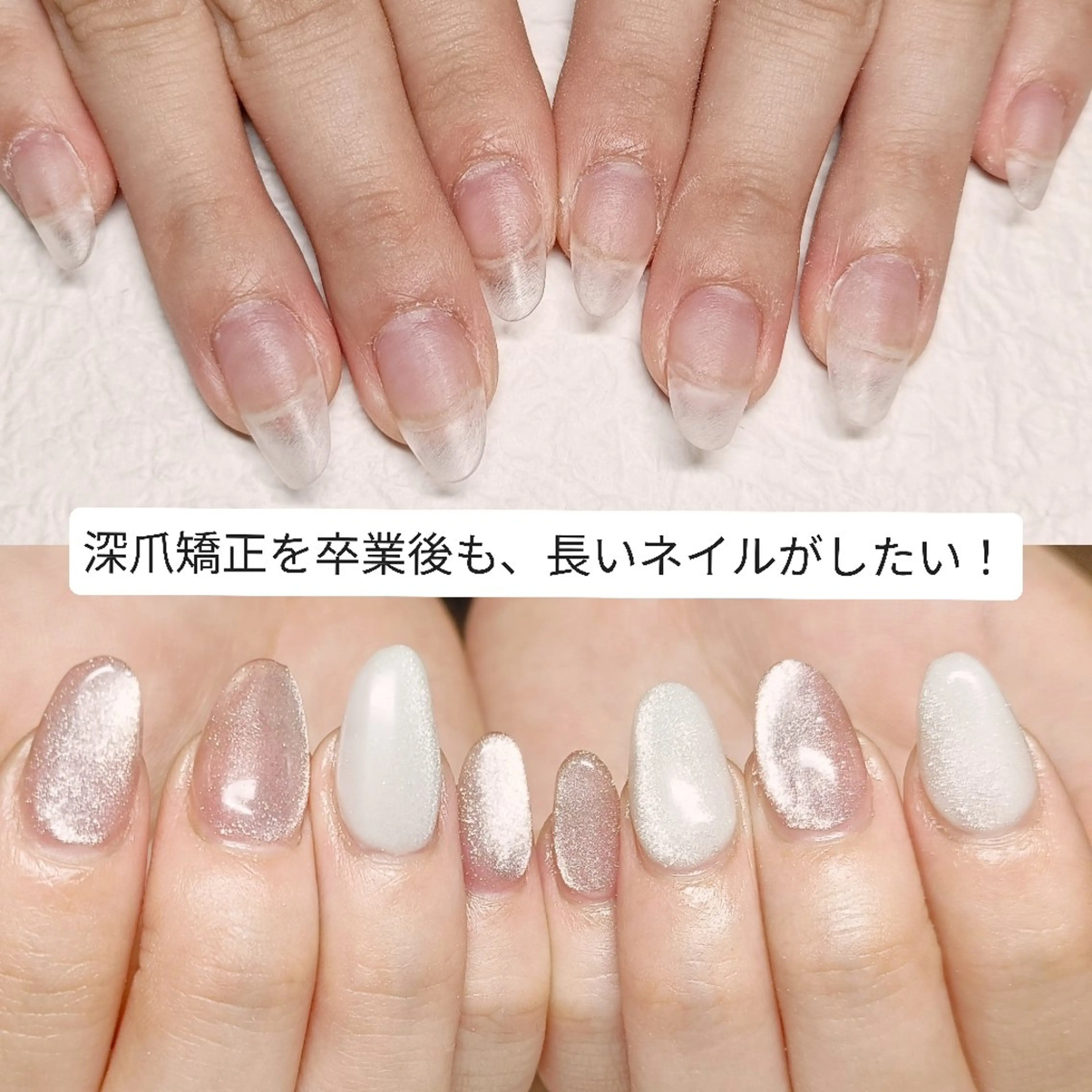 ネイル ロングネイル スカルプネイル ハンドネイル ハンドケア 深爪矯正/爪育成ケア manie nailのネイルデザイン