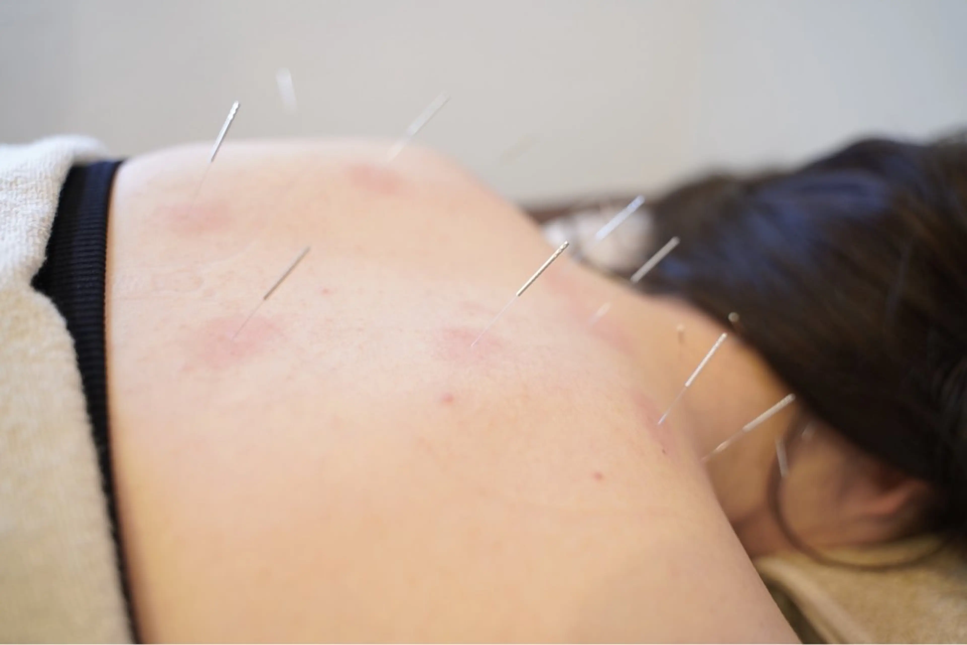 エステ リラク 🌸美容鍼サロン🌸 メゾンブランシェ🌈のエステ・リラクイメージ