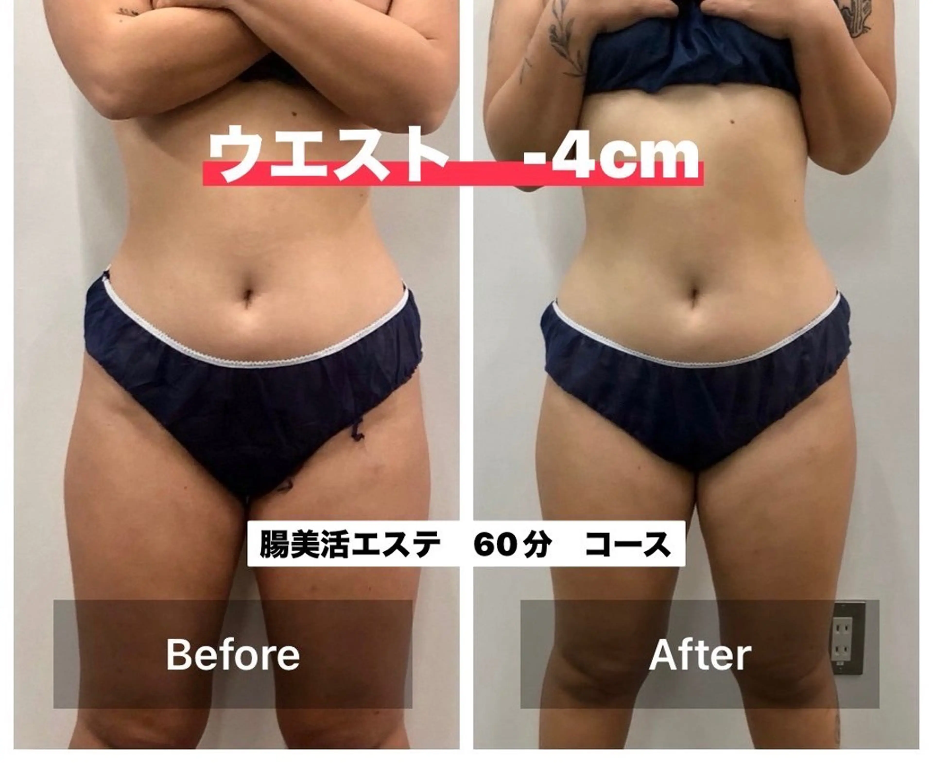 腸美活エステ　60分の写真