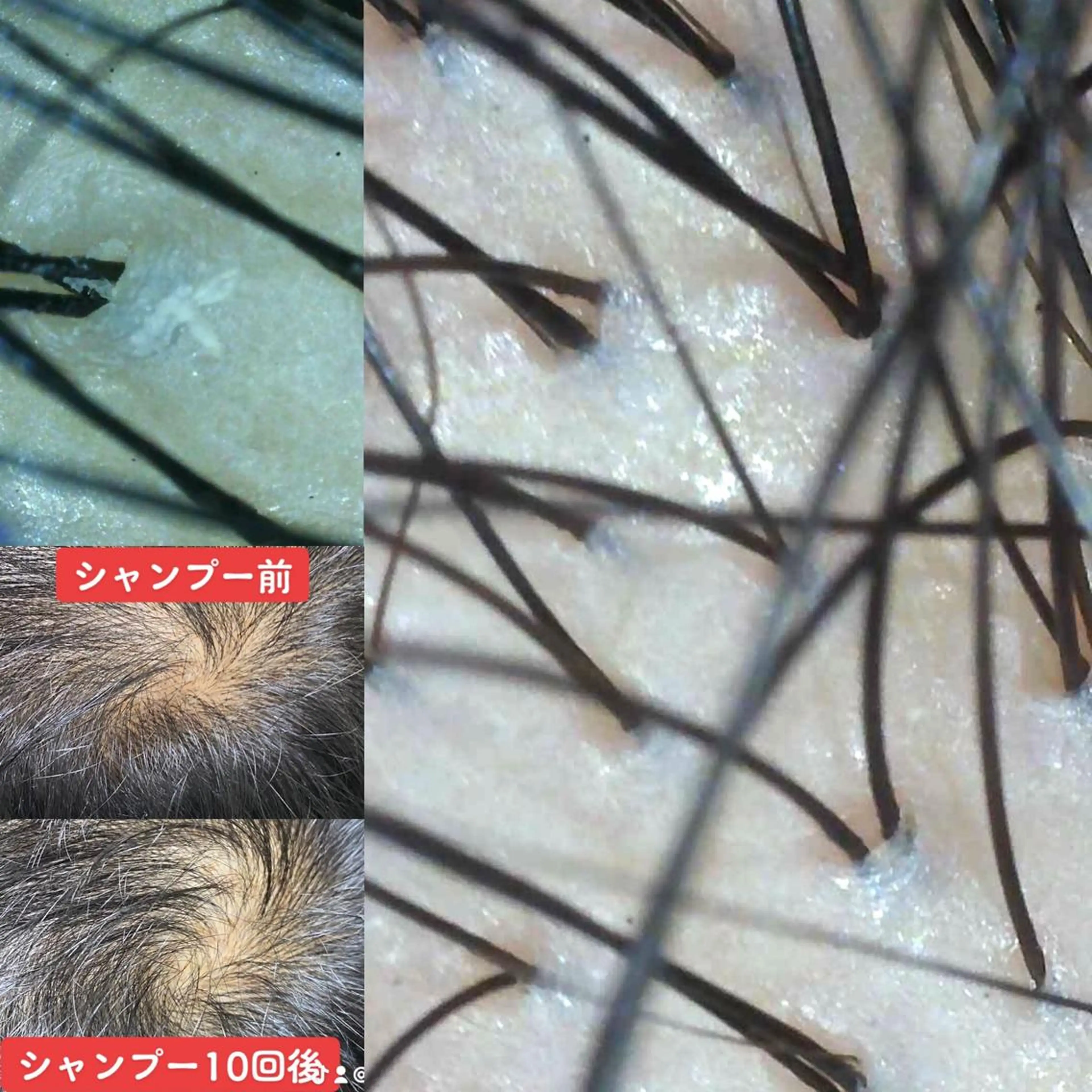 🌸抜け毛や薄毛がきになる方🌸オススメ最新オイルクレンジング+頭皮クレンジングシャンプー+オーガニックトリートメントの写真