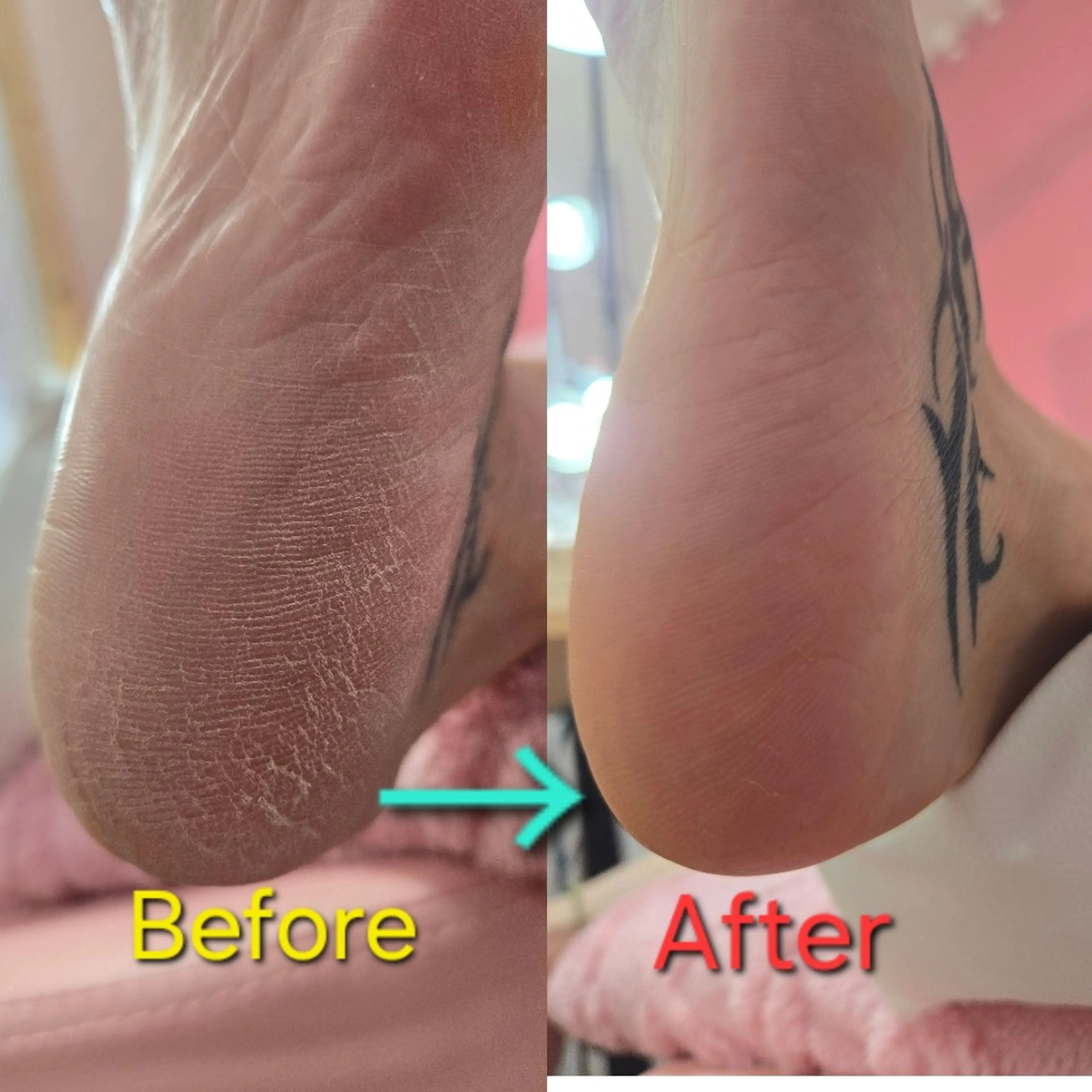 フット角質除去ケア(別メニューと同時の場合1,500円で特別提供)の写真