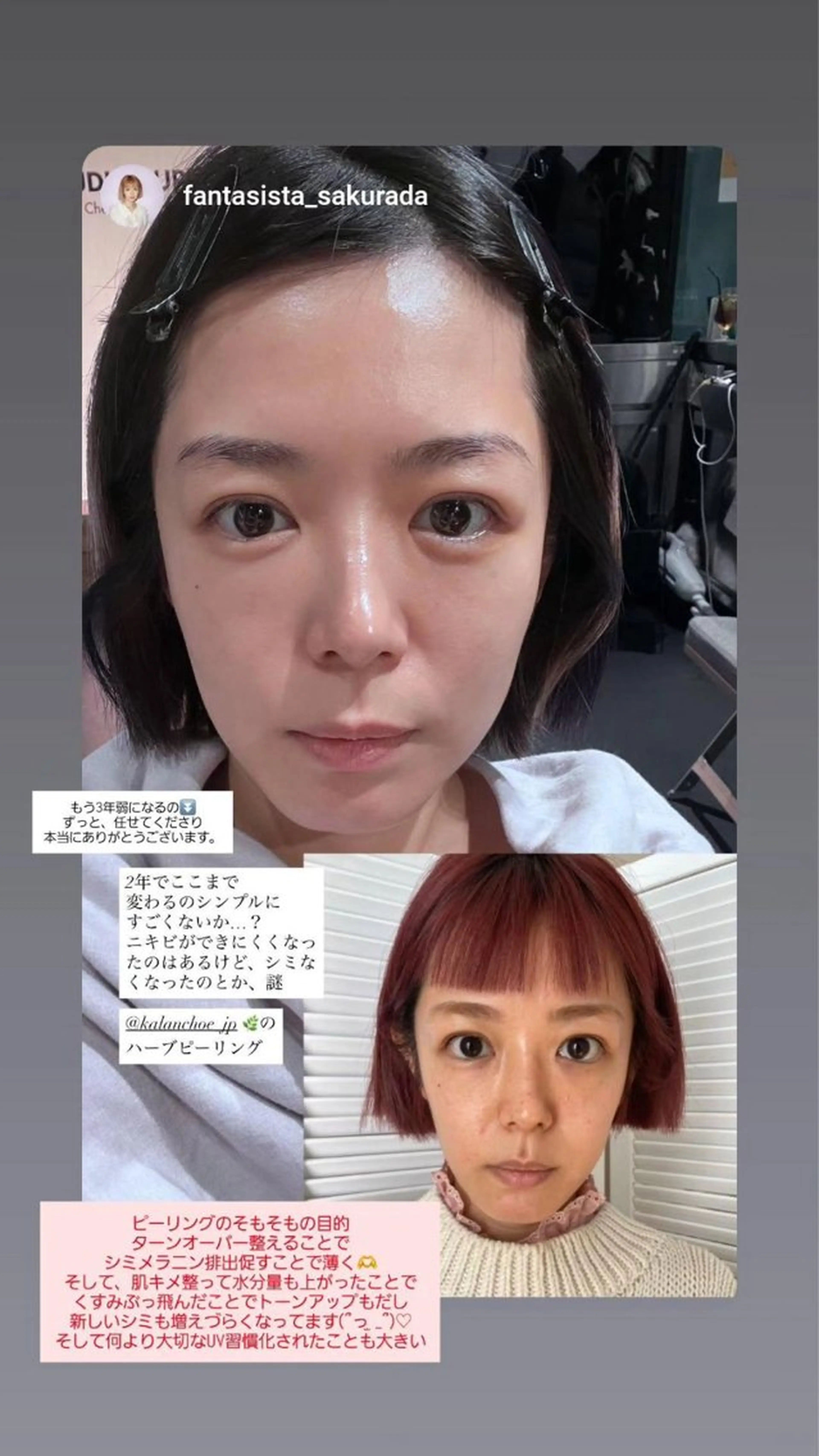 エステ 肌質改善 KALANCHOEのエステ・リラクイメージ