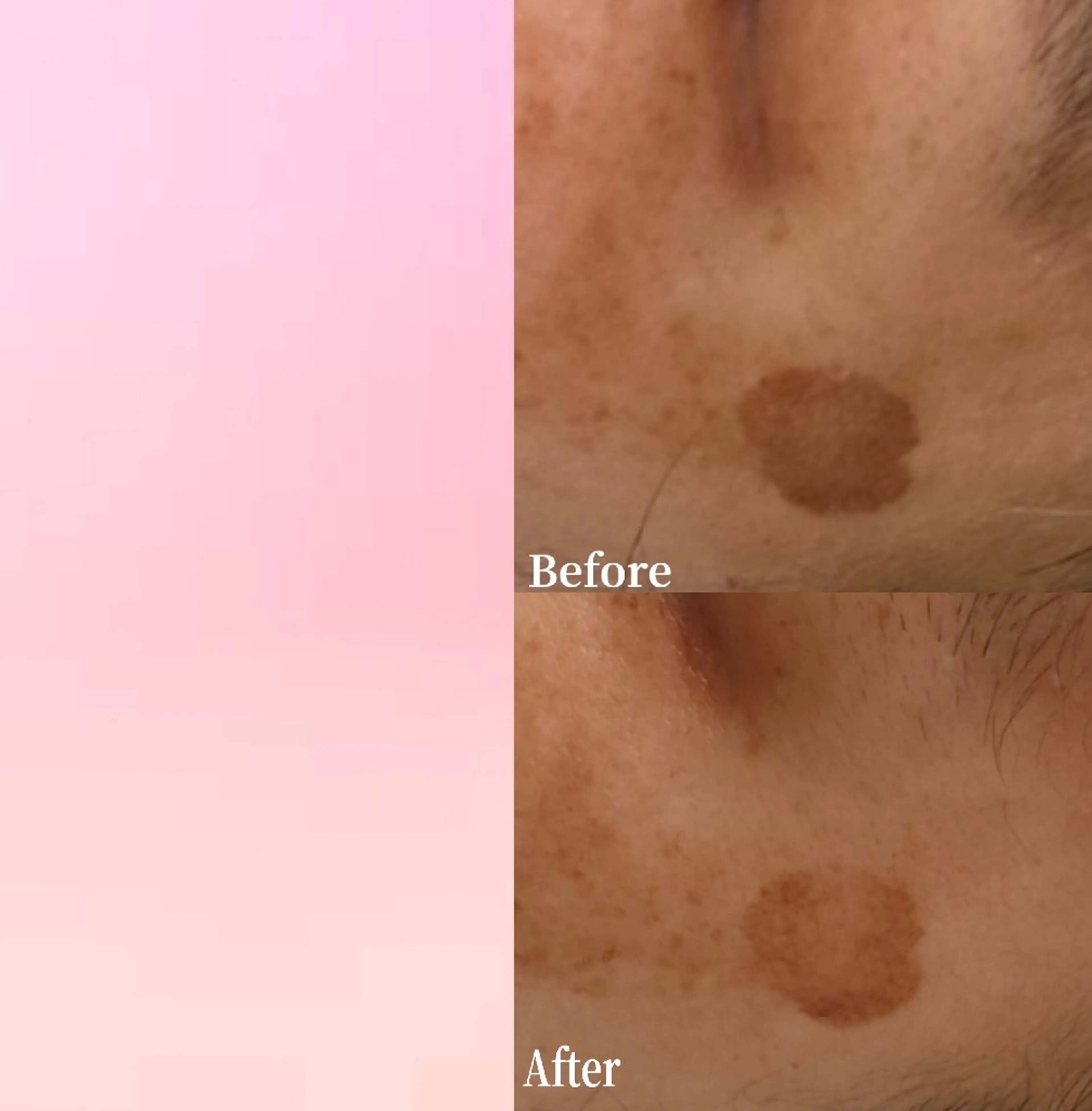 フェイシャルエステ haruのエステ・リラクイメージ