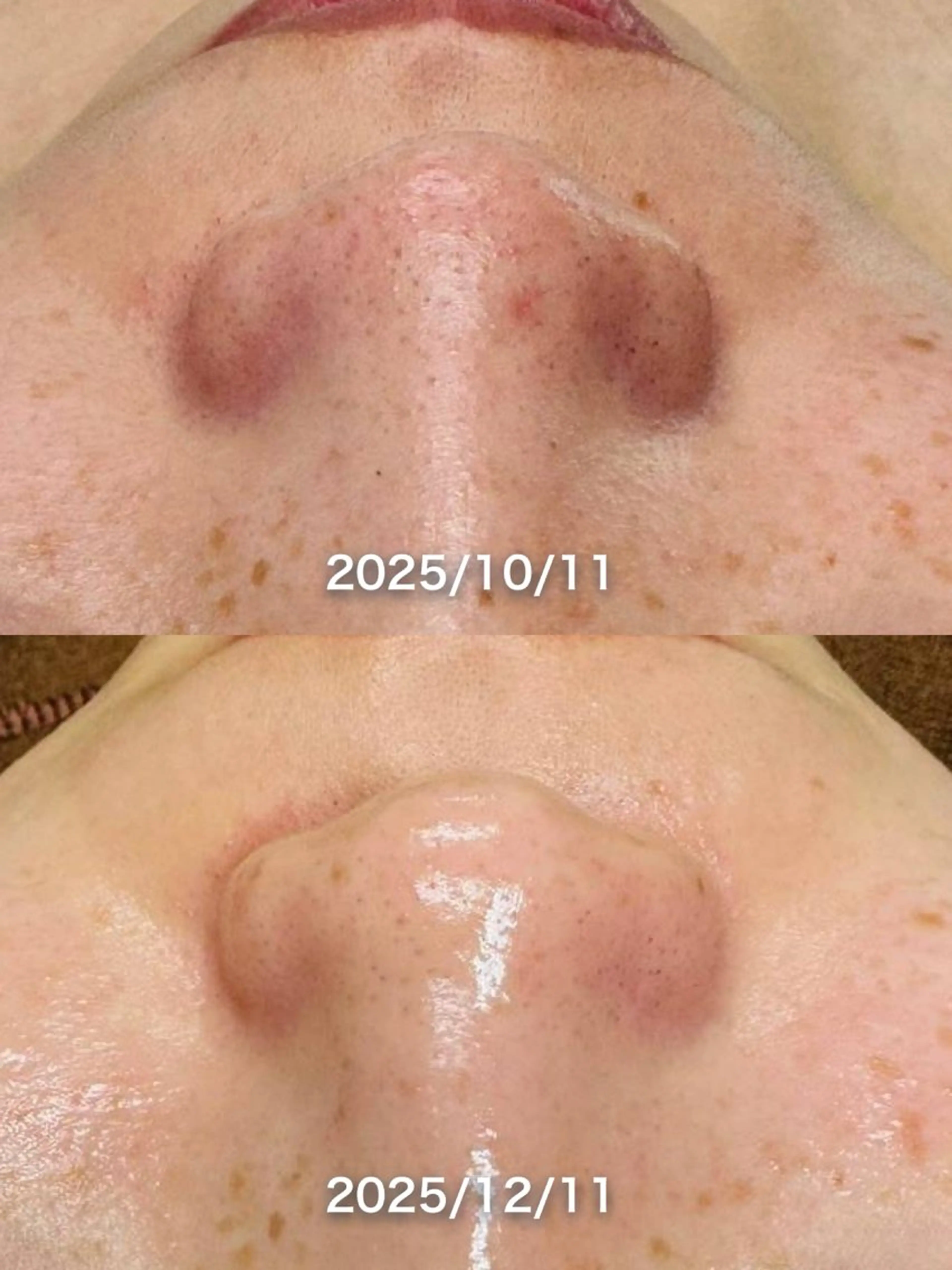 エステ LukeBeauty salonのエステ・リラクイメージ