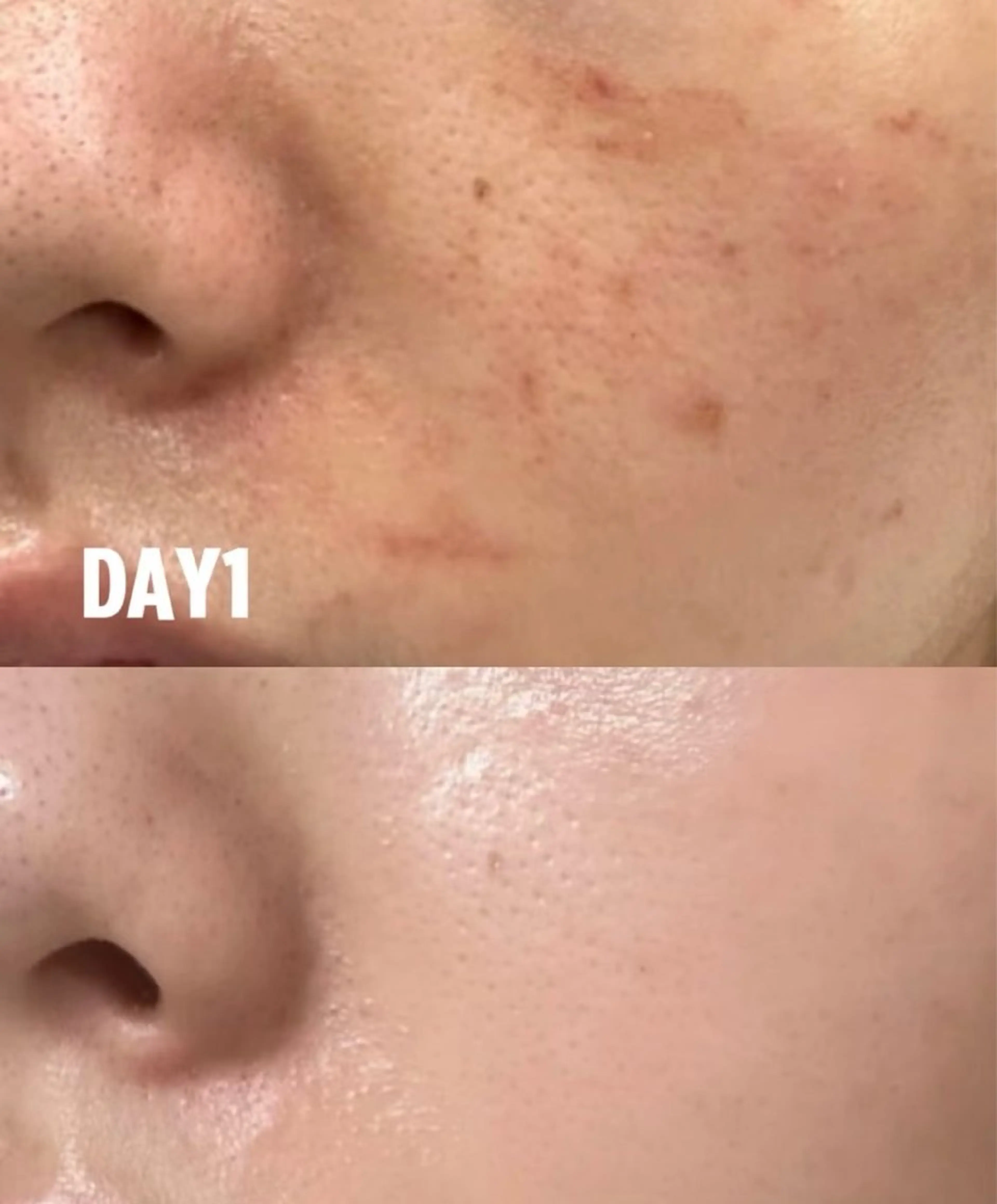 エステ リラク 愛維美水光美肌専門店所属・愛維美水光美肌専門店 メンズレディースokのエステ・リラクイメージ