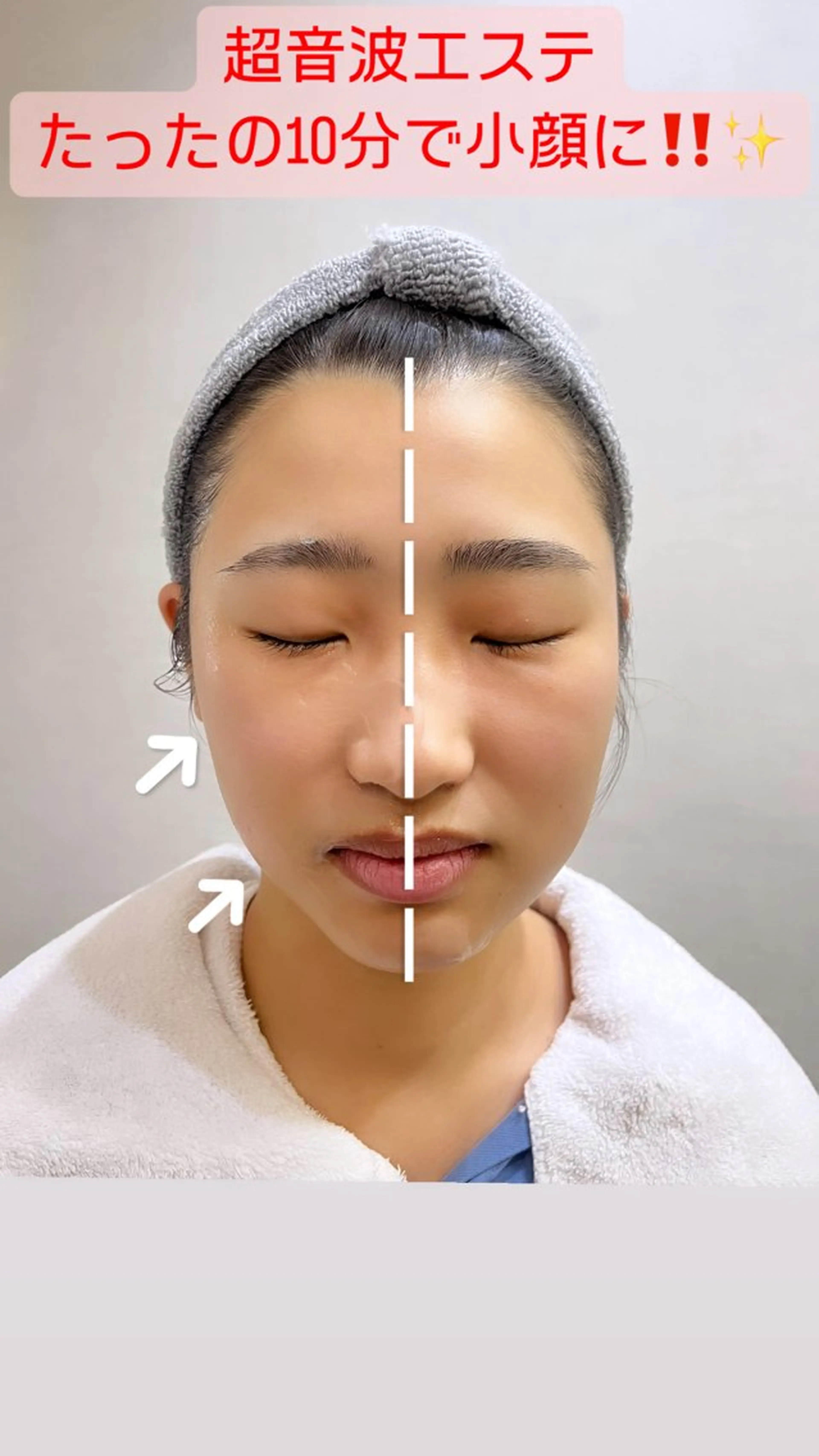 肌の質を変えるエステ 🤍🫧Nanaのエステ・リラクイメージ