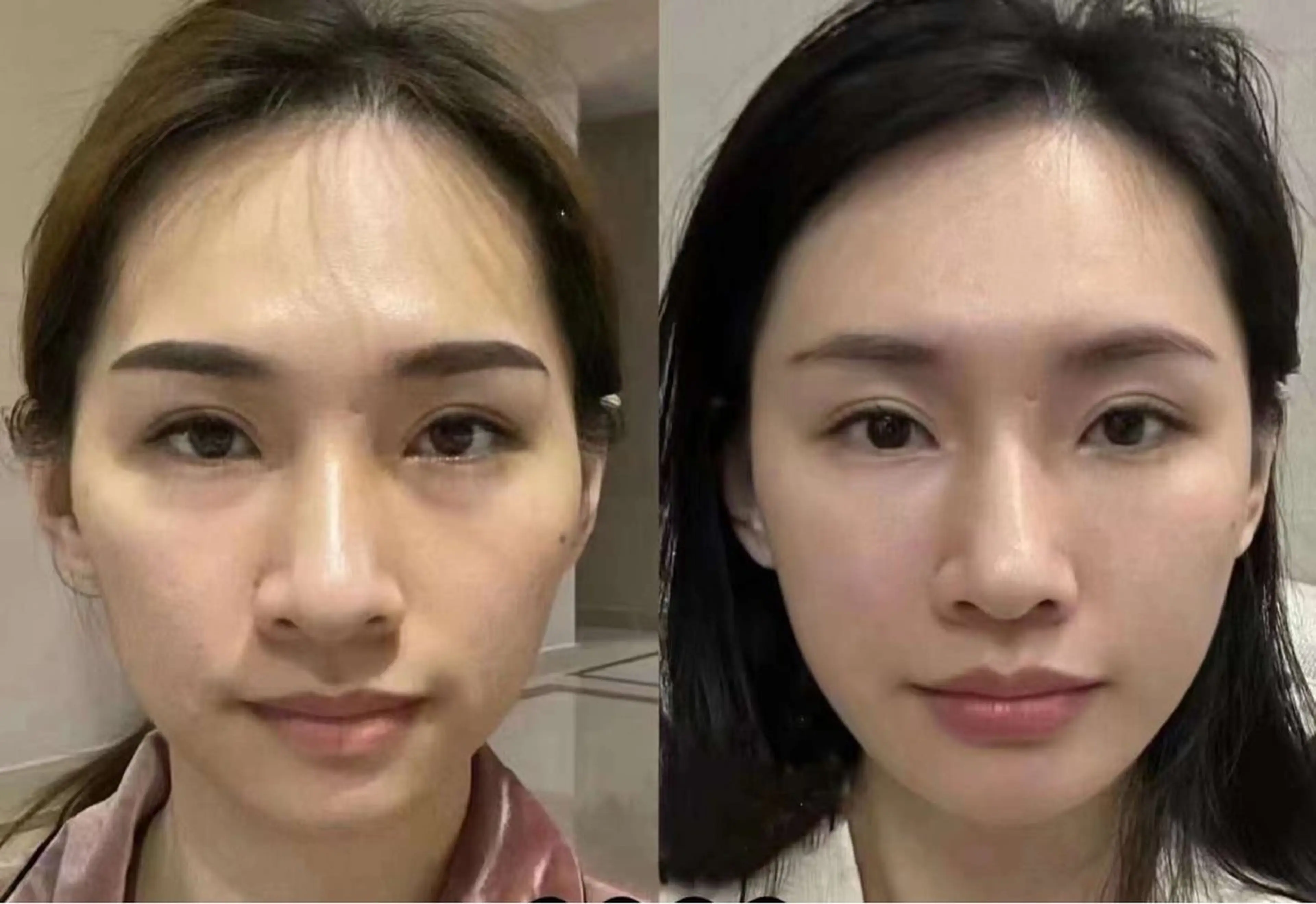 ショート カラー パーマ ネイル マツエク・マツパ 韓国風マツエク 韓国風ヘア 小顔カット 韓国ネイル aliaハーブ水光店 エステティシャン募集のエステ・リラクイメージ