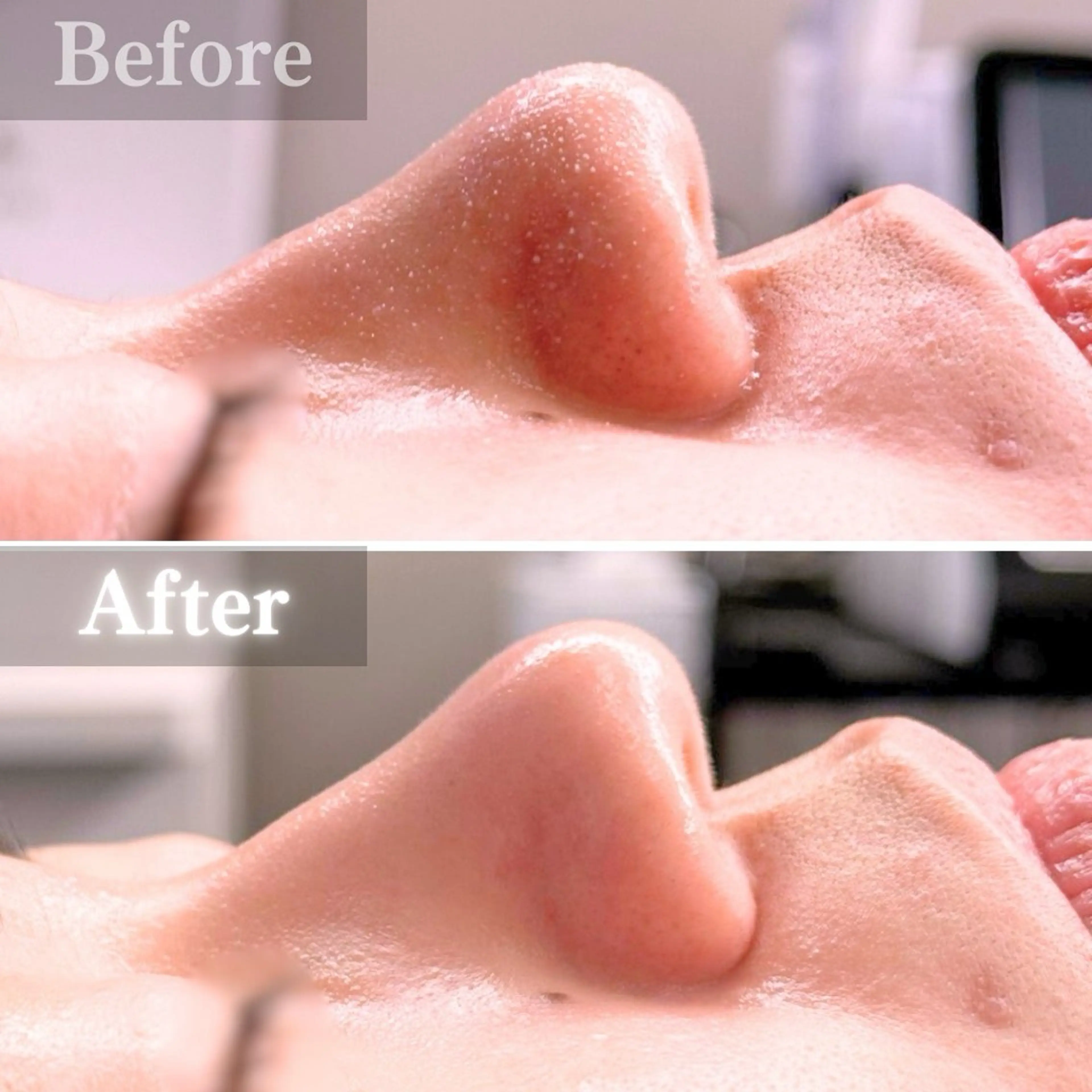 エステ 毛穴洗浄特化🫧 オオツカのエステ・リラクイメージ