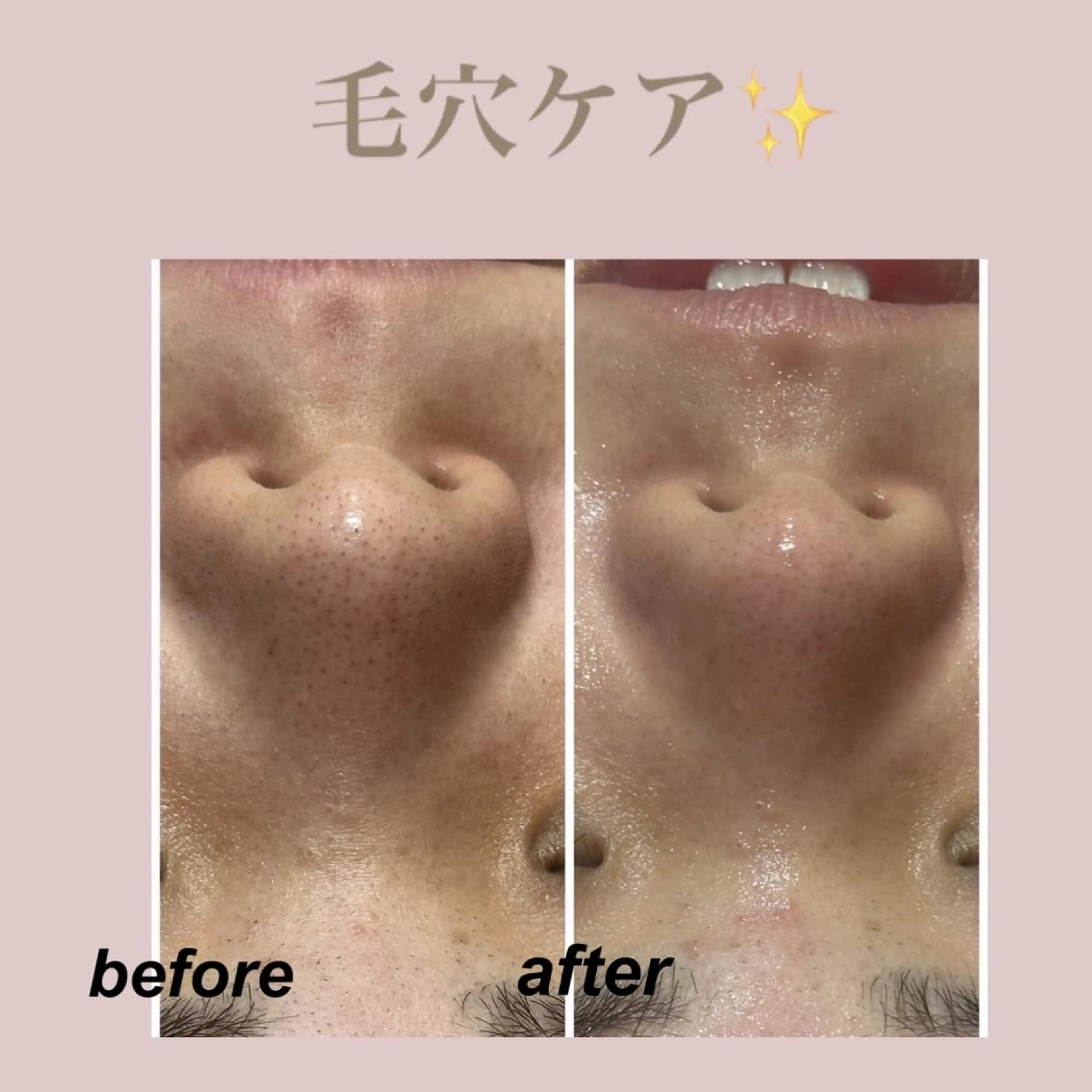 🌈Linora🌈 レイビス 永石のエステ・リラクイメージ