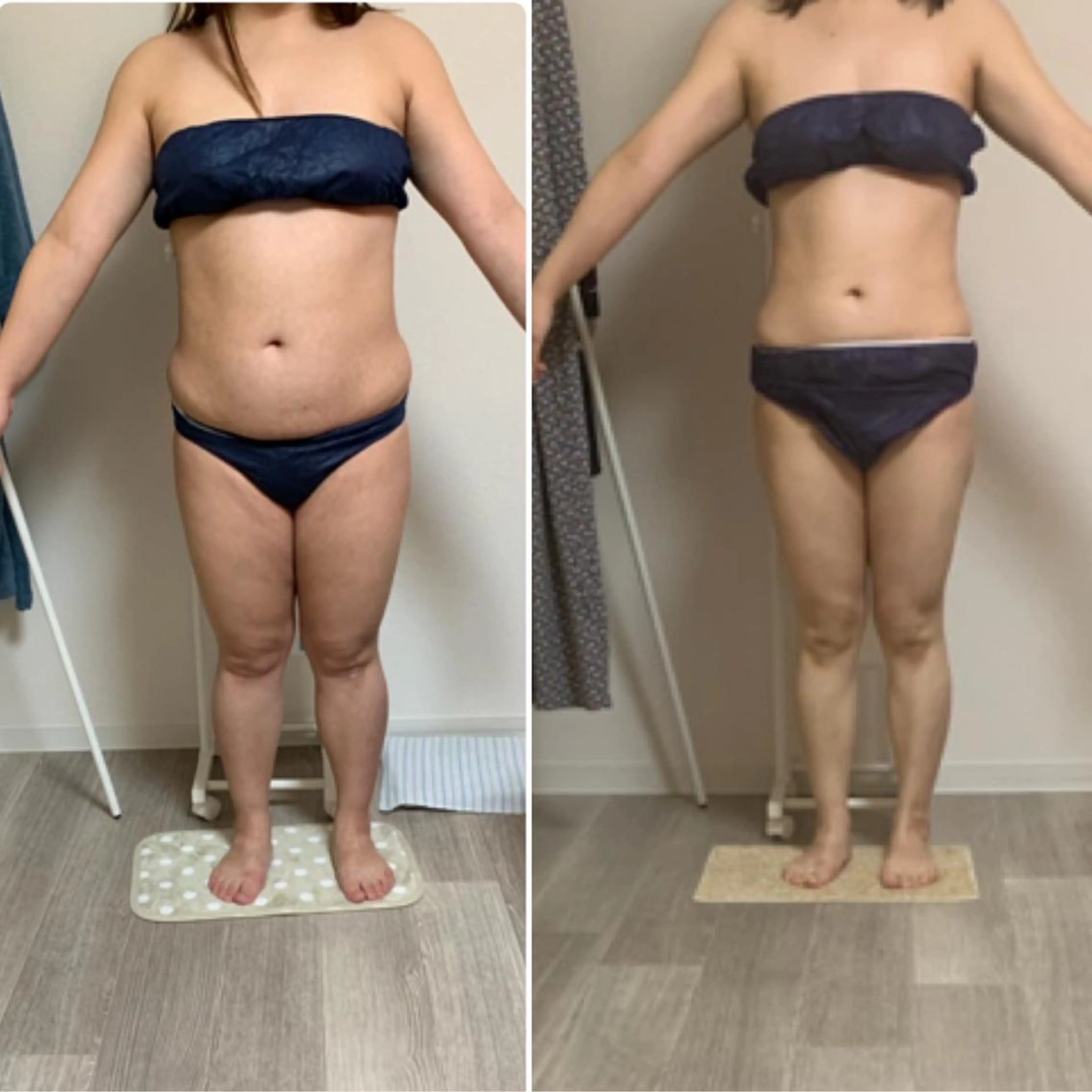 所沢 痩身エステサロンのエステ・リラクイメージ