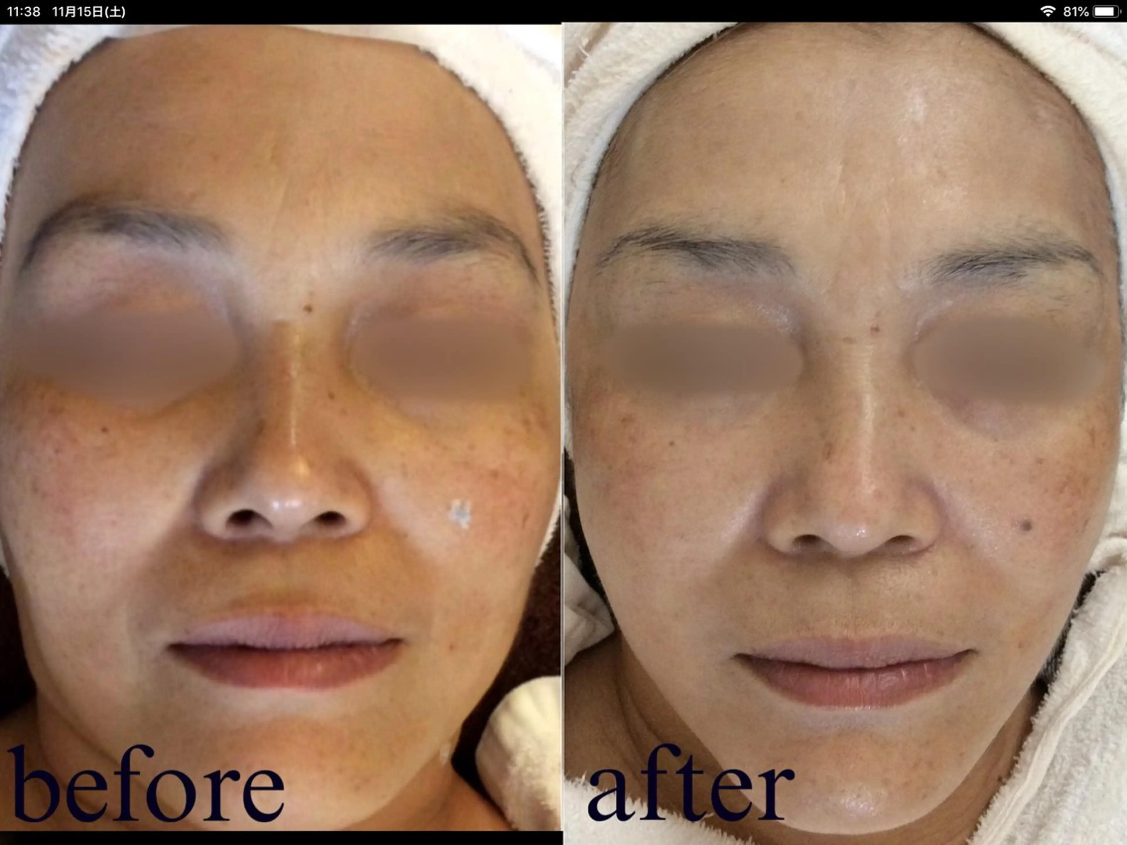 エステ Salon de Bis所属・サロン ド ビス 髙橋美月のエステ・リラクイメージ