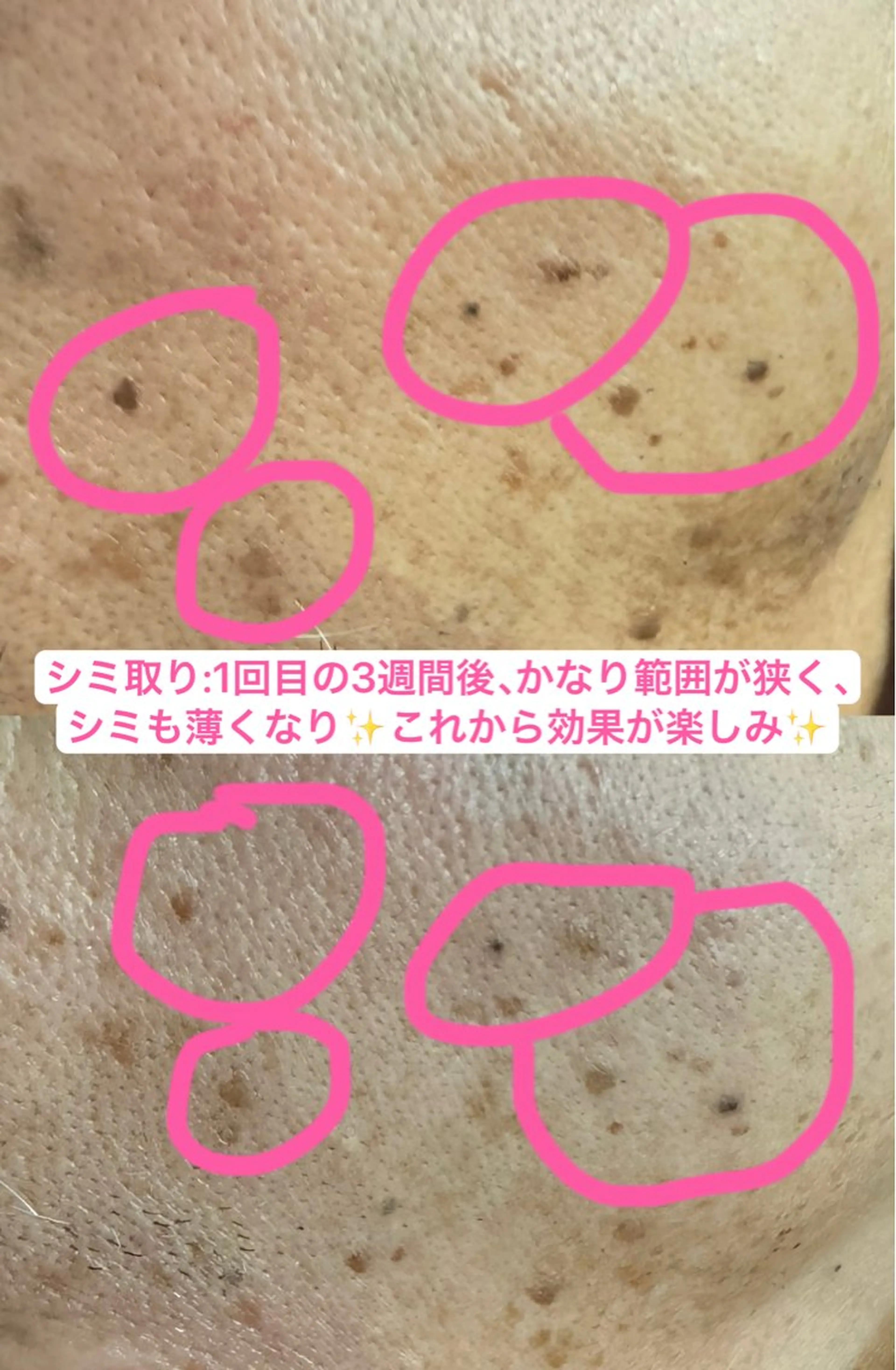 🎀エレガンテ🎀 美肌専門👸本間のその他イメージ