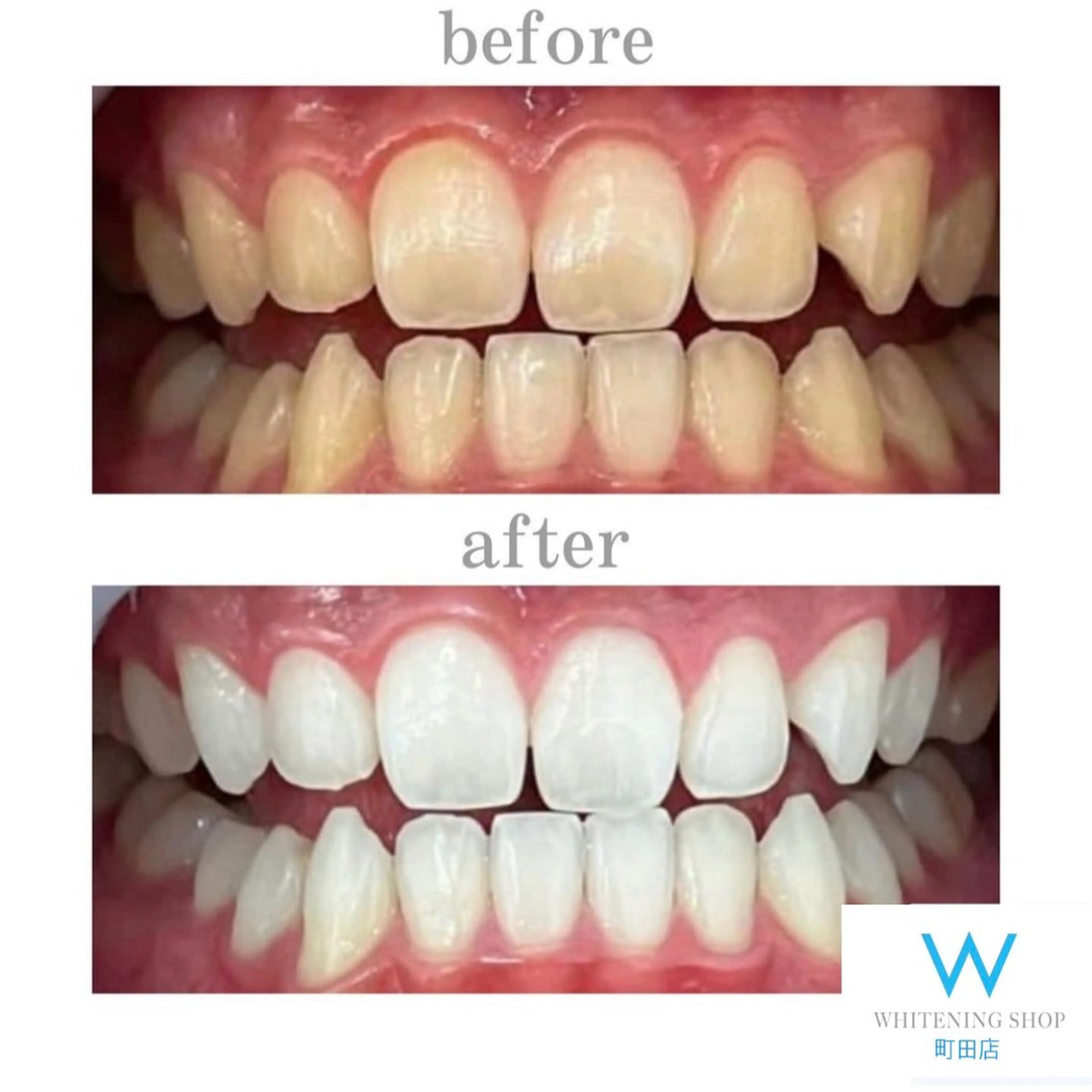 メンズ キッズ その他 ホワイトニング ショップ町田店のその他イメージ