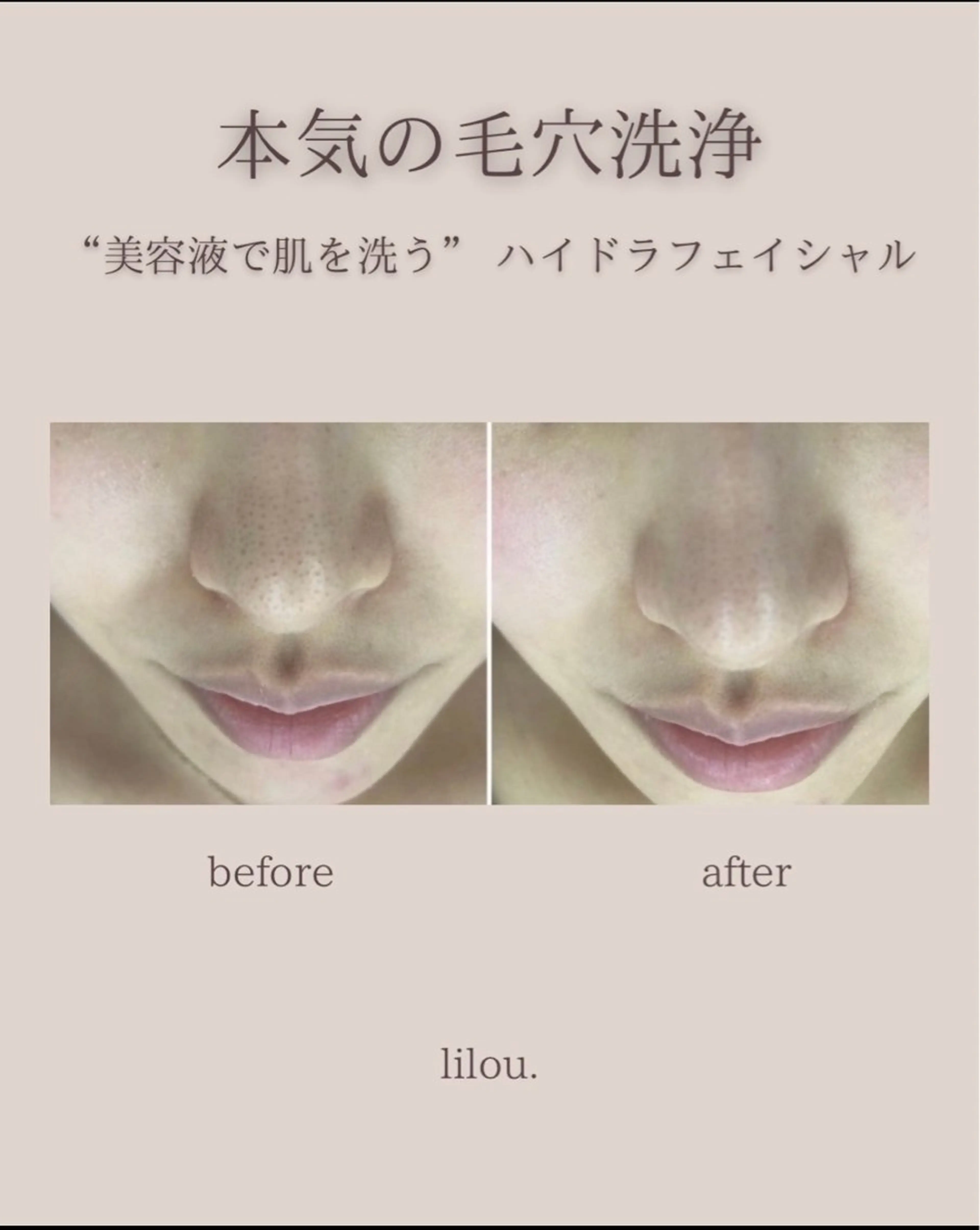 吉田 hue.のエステ・リラクイメージ