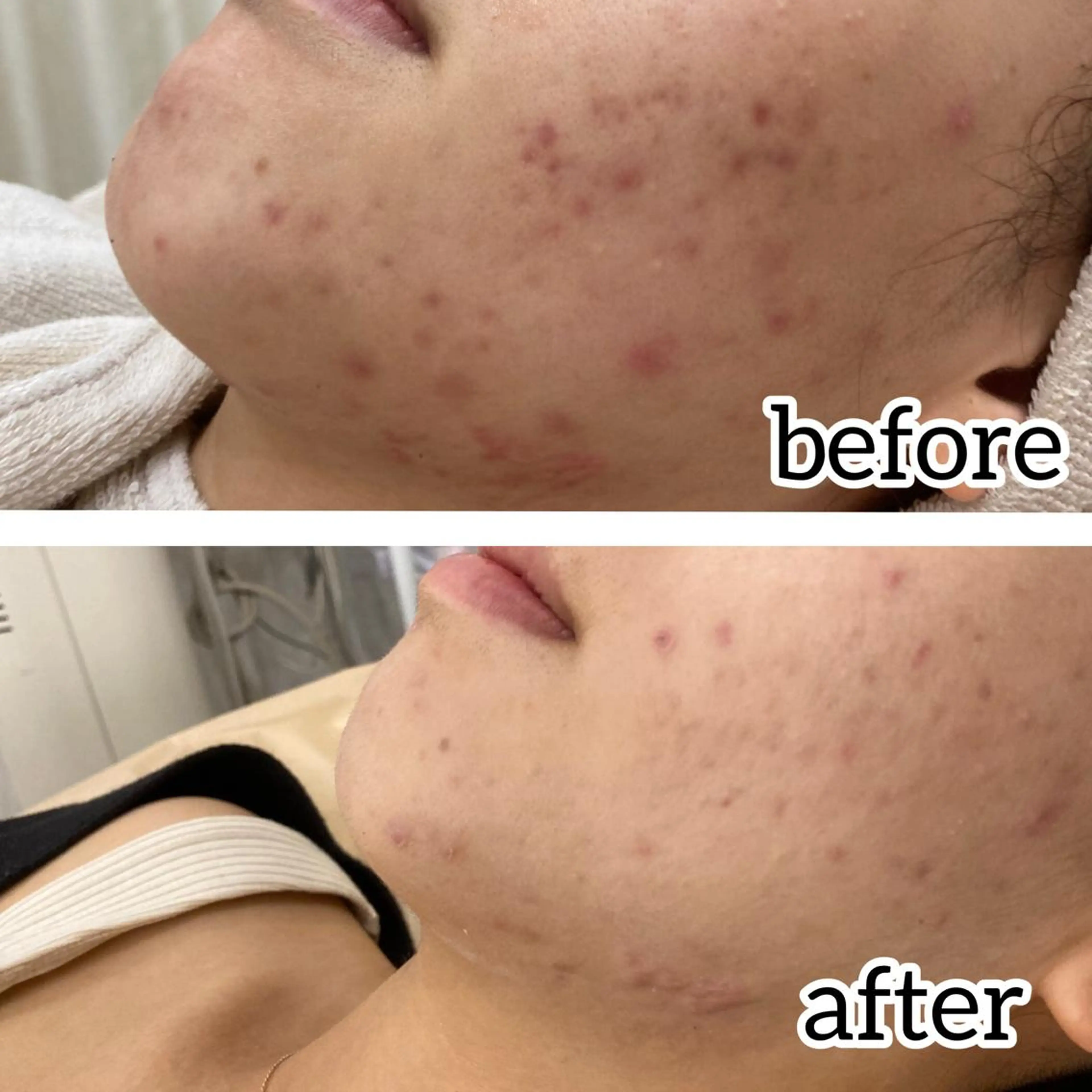 laluna saki...のその他イメージ